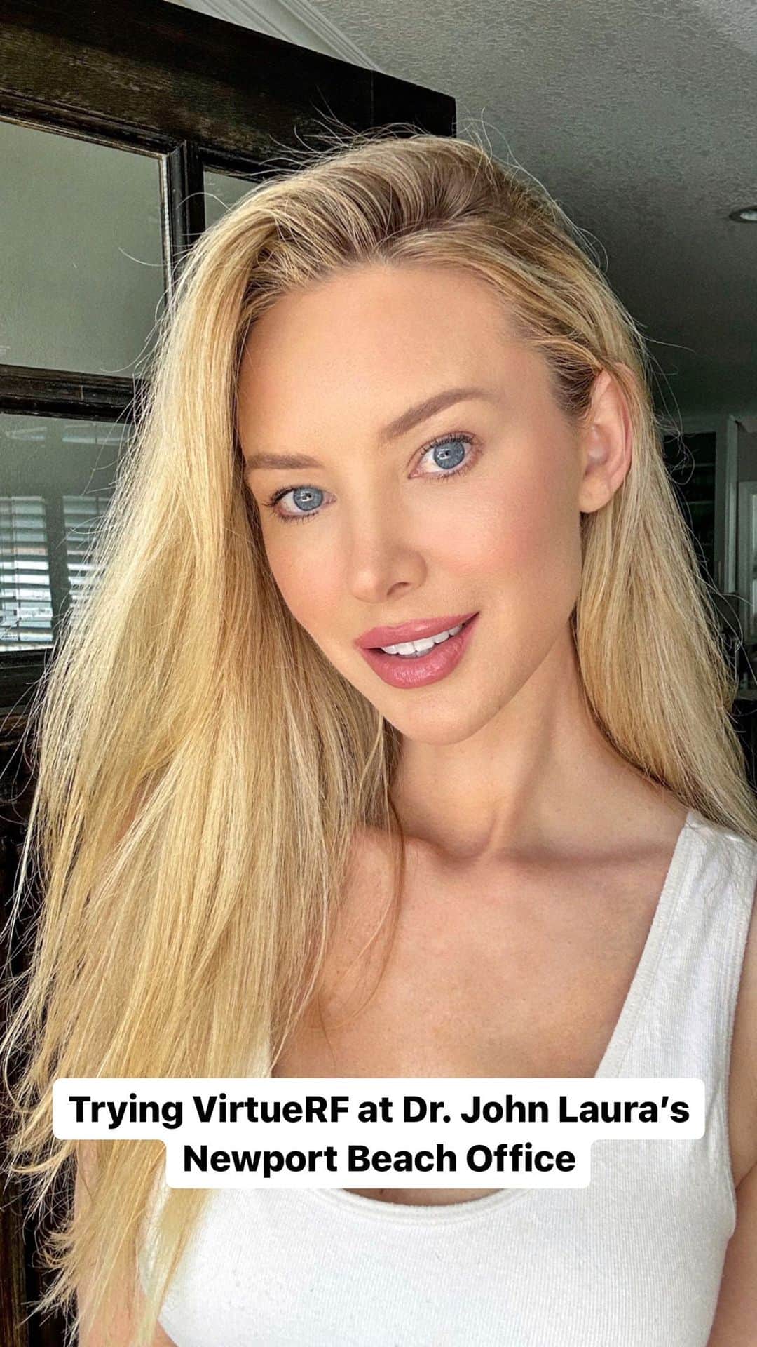 のインスタグラム：「Quick visit to @dr.johnlaura with @nurs.kenzie to try out the #virtueRF 🤍  I’m afraid to try anything too aggressive  so this was a good choice, less pain but still results. ☺️ Virtue RF combines radiofrequency and microneedling to stimulate collagen and elastin. I also noticed my dark spots were pretty much non existant after 🙃」