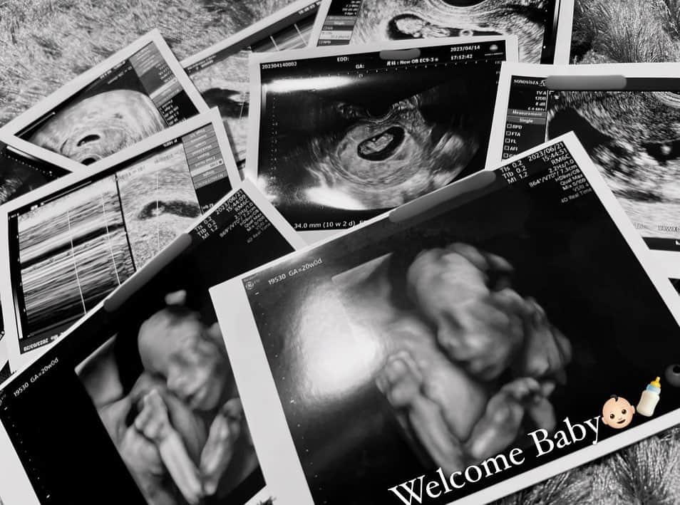 ENAのインスタグラム：「Baby is here…👶🏻🕊💓  この度、お腹に小さな天使を授かりました👼🏼 現在７ヶ月になります！！ なんと予定日は私の誕生日11月8日🎉 運命を感じてます🥹🥹🥹  初期悪阻も軽く、ポコポコ動くベビが可愛くて可愛くて仕方ない毎日を過ごしてます😳 私の大っ嫌いな浮腫み、体重増加、腰痛、貧血と闘いながら 残り数ヶ月のプンニー生活楽しみたいと思います☺️  ご報告遅くなりごめんなさい😢 Instagramの更新頻度が減ってから 心配のDMくれた方ありがとうございます😢 これからも応援よろしくお願い致します✨  #妊娠報告#マタニティ #マタニティライフ #プンニー生活 #妊娠7ヶ月 #小さな天使」
