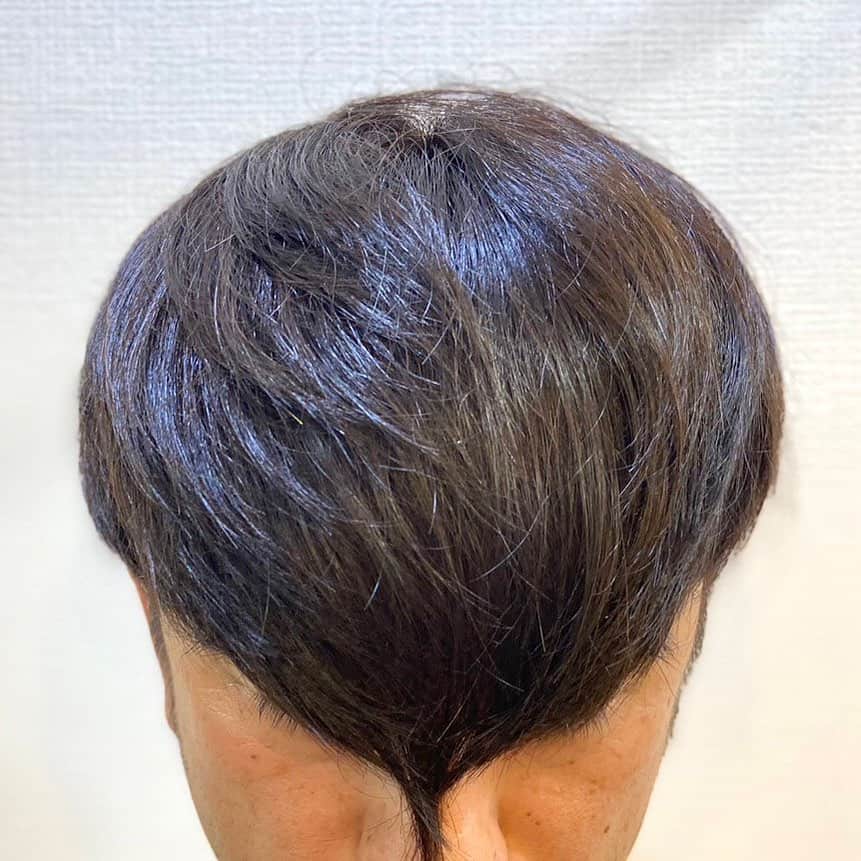 満田伸明のインスタグラム：「前はどうなってるんですか？ ってお問い合わせがありましたので  #満田のくせに」