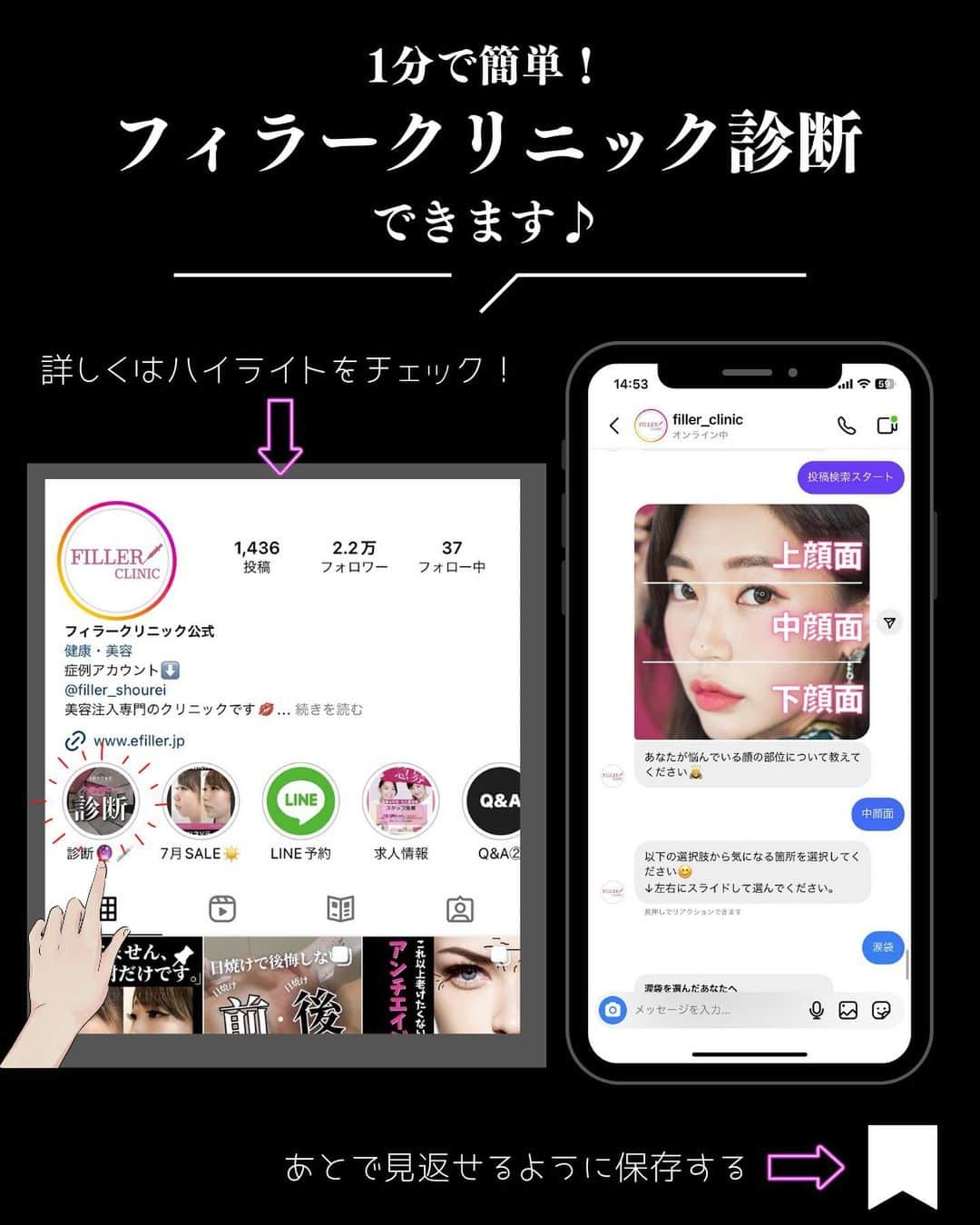 恵比寿フィラークリニックさんのインスタグラム写真 - (恵比寿フィラークリニックInstagram)「金ドブ回避！ 自分に合う糸リフト選びって😏  ----------------- 1分でできるフィラー診断はハイライトに💜 ▶︎ @filler_clinic ◀︎ -----------------  ○フィラリフト アンカー付きの特殊な医療用の糸を挿入し、シワやたるみを引き上げます✨ リフトアップと同時に、糸の挿入により皮膚のコラーゲンの生成をするため肌にハリも出ます🤩  ▼効果 ✅即、リフトアップ効果 ✅たるみ改善 ✅ハリ・艶アップ  ▼料金 1本　¥45,000 (税込¥49,500)  ○シャークリフト フィラークリニック独自の発注ルートで叶った、続けやすい糸リフトです。 リフトアップ効果はナチュラルですが、たるみ予防に最適です。  シャークの効果 ✅たるみ予防 ✅自然なリフトアップ効果 ✅肌質改善  ▼料金 1本　¥12,000 (税込¥13,200)  ○韓国式美容針(ショッピングリフト) お肌の若返りを求めるならコレ❣ 極細糸が付いた非常に細い針を皮膚の浅い層に挿入する事で 皮下組織のコラーゲン再生を促進させます✨  ▼効果 ✅ハリ・艶アップ ✅毛穴の引き締め ✅トーンアップ  ▼料金 10本　¥30,000 (税込 ¥33,000)  この機会にぜひお試しください🥰  #フィラークリニック #糸リフト #フィラリフト #シャークリフト #フィラークリニック #ショッピングリフト #韓国式美容針 #韓国 #美容針 #針 #リフトアップ #リフトアップ効果 #リフトアップマッサージ #リフトアップしたい #たるみ改善 #たるみ #たるみケア #たるみ治療 #たるみ毛穴 #たるみ解消 #小顔 #小顔マッサージ #金ドブ #プチ整形 #整形 #美容 #美容好き #美容好きな人と繋がりたい #メンズ美容 #美容男子 #美活」7月26日 18時20分 - filler_clinic