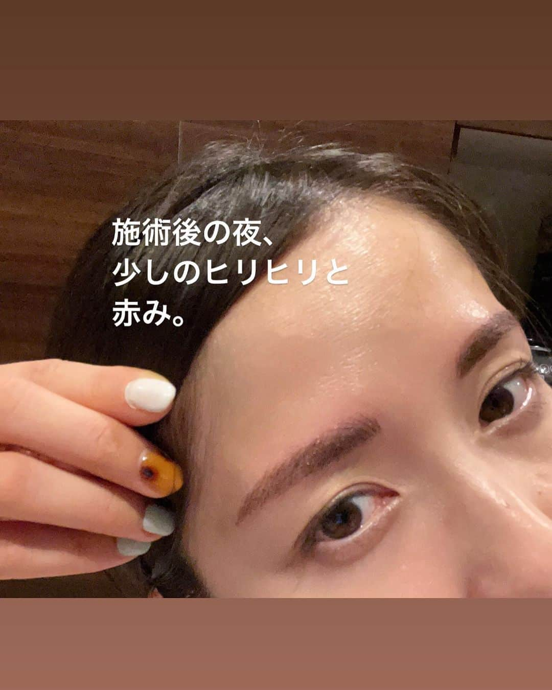 松木里菜さんのインスタグラム写真 - (松木里菜Instagram)「.｡･*. @artmake_by_yuen_  初✨眉アートレポ！ 1枚目は施術後すぐ！ 担当してくれた 小澤夏鈴 @karin_artmake さんと♡  丁寧に私に合う眉と、私が好きな眉の形と、下書きを何度も描き直しながら理想の形を一緒に見つけてくれました！ 自分の顔の黄金比眉毛ってわからないですよね😳 安心してお任せできたし、ほんと理想的な眉毛になりました♡  周りにも迷っているお友達がたくさんいるんですが、全力でお勧めしてます✨ ちなみに @karin_artmake さんの旦那さんもアート眉されているとのこと。メイクできない男性にもいいですね！  今日から1ヶ月の間は投稿を見て予約をすれば15,000円off(それ以後は10,000円off)にしていただけるそう！  施術してくれる方の腕が心配でいつもどうしようかと悩んでいましたが、 @karin_artmake さんにお願いできてよかった👍💕  眉毛かかないことがこんなに楽なんて✨最高だぞー😍  #アートメイク #恵比寿　 #ArtmakebyYUEN #アートメイク東京  ちょっと詳しく↓  今までテキトーにカットしていた眉のお手入れの仕方も教えてもらえました😂✨ 施術後はとにかく感動しまくりでこの笑顔😆  痛みが心配でしたが、施術中は麻酔が効いていて全く痛くなかったです！ その日の夜は赤くなり少しヒリヒリしましたが、翌日には私は赤みも痛みもなくなりました🙆‍♀️ 翌日の写真撮り忘れたのだけど、少しだけ濃く凛々しく見えたかな🤨  そして施術4日目の今日はもうとっても自然に！ 一週間は激しい運動(滝汗レベル)やサウナはNG そして日中もワセリンをうっすら塗らないといけませんが、前髪もあるし誰にもワセリン気が付かれません🎵 眉の色も髪の毛の色や好みで選べます⭕️ 検討されている方の参考になるといいです(^^)✨」7月27日 20時02分 - rinamatsuki613