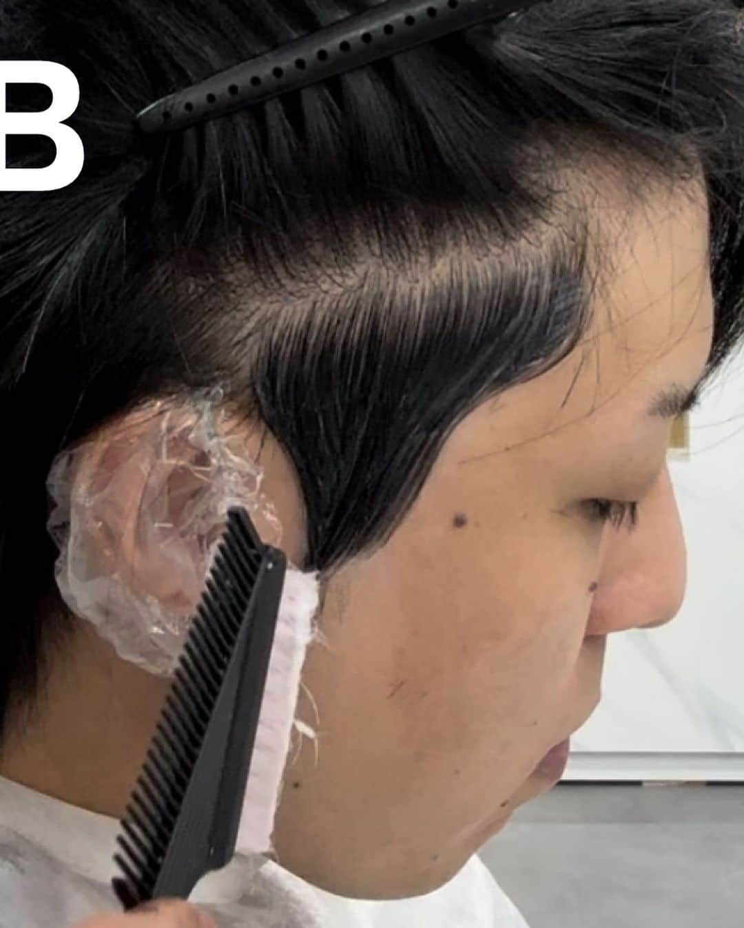 松村 明輝 外国人風 横波ウェーブパーマ バレイヤージュ講師さんのインスタグラム写真 - (松村 明輝 外国人風 横波ウェーブパーマ バレイヤージュ講師Instagram)「メンズ整形パーマの全貌 頭の形・毛穴の向き・髪の形・髪質この4つを整形していく技法です。  今回は簡単に内容を説明していきます。  A  前髪の毛穴の向きを決める  B サイドを9mmで刈り上げてサイドの膨らみを抑えながら毛流れの方向性を決めます、この時、決して肌を透けさせてはいけない。肌が透けるまで刈り上げると男っぽくなってしまうので気をつけましょう。  C 襟足の毛流れも決める。浮きやすい場合はしっかりと抑えるて下さい。  D トップの毛穴の向きを決める。薄毛の場合は、しっかりと根元を真上に持っていくとふんわりしやすいです。  E 熱処理で、根本の立ち上がり形を作っていく。薄毛や頭の形が平らな場合、ボリュームアップするように根元を丸めます。  E 作った形をしっかり固めていく。同時に、特殊な薬でお客様のご要望によってハリコシタイプかしなやかタイプの髪質に変更して仕上げましょう。  以上がメンズ整形パーマの流れです。  #韓国風パーマ #メンズパーマ  #メンズ整形パーマ」7月28日 7時31分 - haruaki_matumura