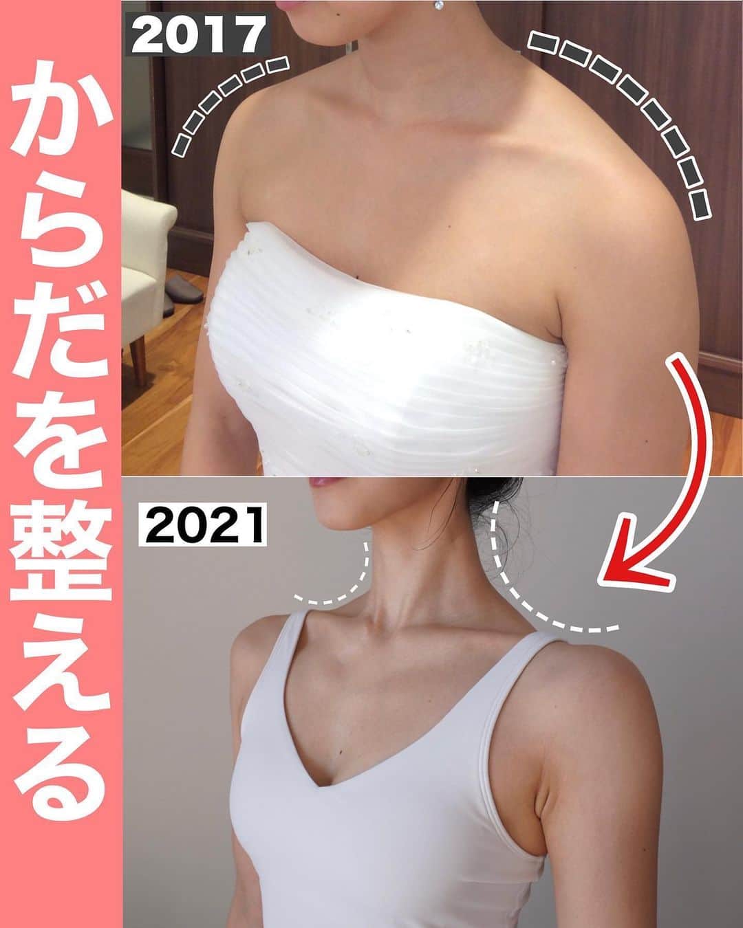 佐川裕香のインスタグラム：「\月額オンラインレッスンお申込み受付け開始‼️✨/   足のアーチ🦶が潰れ続けることは背骨にも影響.. 画像のような、首・肩にも関係します  月額オンラインレッスン5週目は通常お休みですが、 8月はからだの土台でもある『足』にフォーカスした 特別レッスンを行います！※アーカイブ期間限定あり  重力、床からの反力を味方に 力みなくリラックスしている状態こそが 見た目のシルエットは美しく、からだは楽になっていきます✔️  猫背の時にみっともない！ もっと姿勢正しなさいと言われ続けましたが、 それで解決しなかった私のように  身体の骨格、姿勢は“意識のみ“で解決できないからこそ U-FIXでは実践しながら、構造を理解！  姿勢を改善する“過程“こそが大切だと感じます。  身体も歯列矯正のように、時間はかかるけれど “習慣が変われば結果が変わる“ 着実に変化へ繋げていきましょう🌱  --------------------------------------------  根本からからだを変えていきたい方の為の オンラインレッスン✔︎  ▶︎募集期間 →7/29(土)21:00〜8/6(日)23:59まで‼️  ✳︎5週目は通常お休みですが、8月は特別レッスンを開催 『重要！からだの土台づくり・足・膝下調整』  この機会にぜひご参加下さい😊  ✔︎お申込みいただいたその日から 過去２ヶ月分のレッスンアーカイブを視聴可能 ✔︎9割以上の方がアーカイブのみでご参加下さっています  プロフィールのURL、MOSHサイトから お申込み受付けさせて頂きます✨  --------------------------------------------  We are accepting applications for monthly online lessons! For more information, please visit the instgram URL✨  https://mosh.jp/services/107752  Languages are here ●Subtitle languages↓ *May be English only in some areas  English/한국어/繁體中文/‎العربية/Italiano Bahasa Indonesia/Svenska/Español/ไทย/Deutsch/Türkçe Français/Tiếng Việ/ Português/Русский  --------------------------------------------」