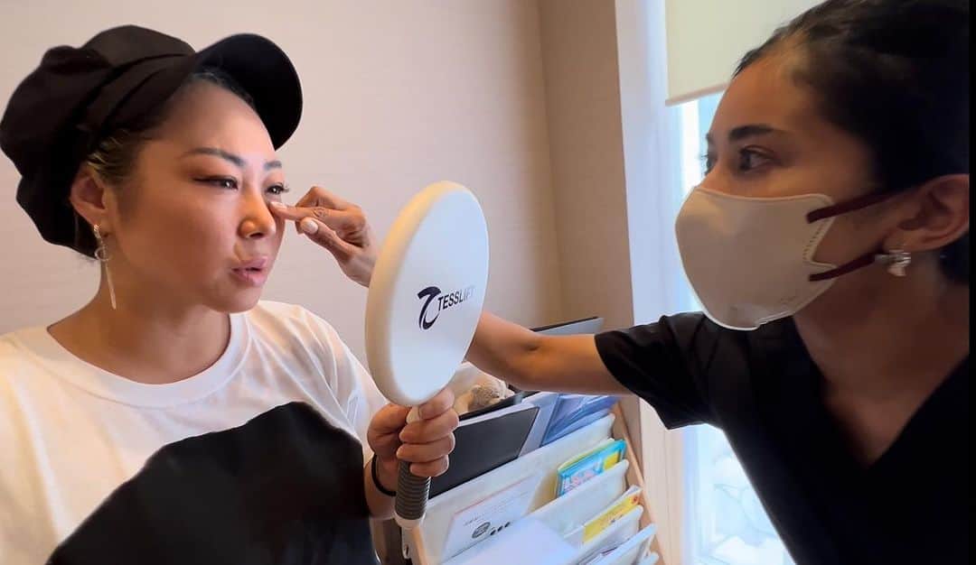 ルナのインスタグラム：「鏡よ鏡🪞世界で一番美しいのは誰？ まさかのMirror続きw 実は私バッこしなダウンタイム中だったんです🤫 アレやコレや積み重なって編集追いつかず🫨 久しぶりにYouTube🆙 この悩みは沢山のDMやコメントでも1位の美容内容でした！ @rejuvamedicalclinic さんで 遂に夢に見たコンプレックスを解消？」