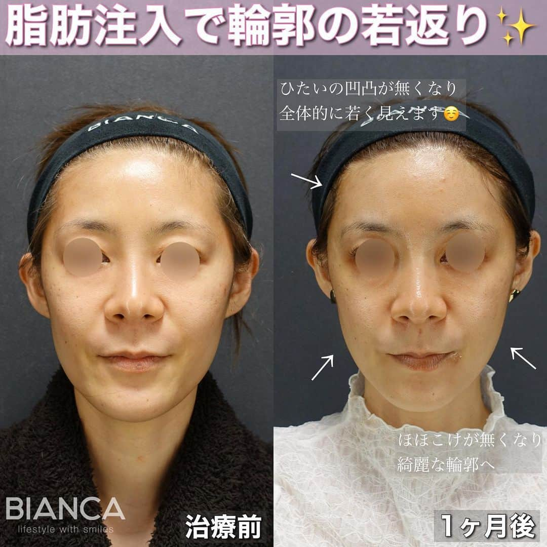 辻沢由有（BIANCA CLNIC 表参道院 院長）のインスタグラム