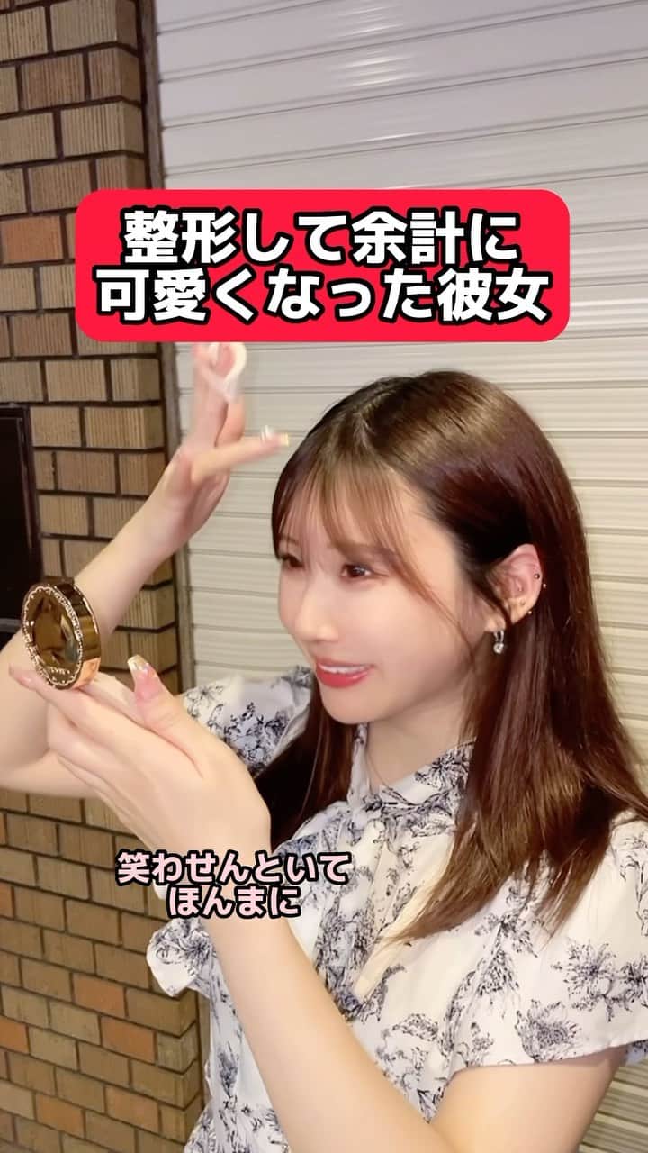 のインスタグラム：「ヒアルロン酸めっちゃ有能🥹💓#整形#ダウンタイム#大阪グルメ #ヒアルロン酸#ボトックス」