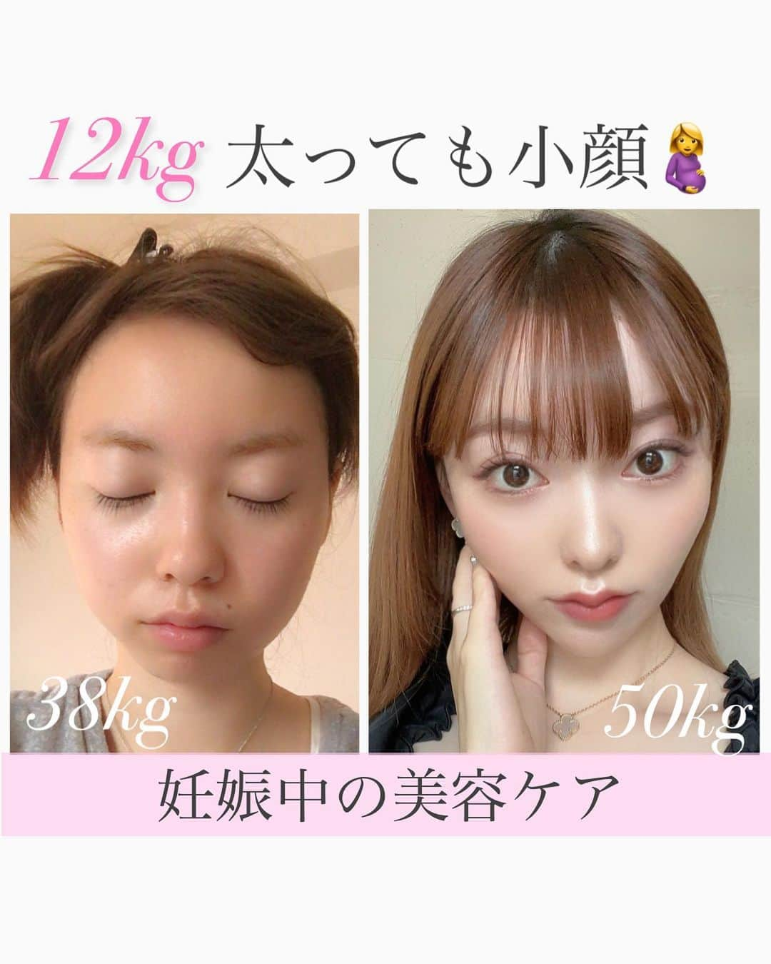 水紀華のインスタグラム：「⁡ ⁡ 妊娠してから12kg太り 自分史上MAX体重に🤰笑 ⁡ 50kg代は人生初めての経験で びっくりしたけれど ⁡ ⁡ インナーケア ✖️ 外側からのケアで ⁡ 38kgの時よりも 顔や脚がスッキリできている🥰 ⁡ ⁡ ⁡ 様々な施術や美容品、講座等に数千万単位で 課金してきたからこそ 本気で変わることができる美容方法や アイテムたちがわかる☺️💖 ⁡ それらをこれからも 身をもって伝えていけたらいいな🫶 ⁡ ⁡ ⁡ ⁡ 【〜8/15 までのプレゼントキャンペーン】 ⁡ いつもcocominをご利用のお客様への プレゼントになります🎁 ⁡ cocominでのサービス 取り扱っているスキンケア・美容品は全て対象 ⁡ DMで上記のご感想を教えて下さい💌 ⁡ ⁡ ⁡ 送ってくださった方の中から 各アカウント10名にプレゼント✨ ⁡ ⁡ ⁡ ⁡ ⁡ ⁡ ⁡#美容サロン経営 #美容サロンオーナー #ダイエット方法 #産後ダイエット #顔痩せ #エニシーグローパック正規取扱店 #エステプロラボ正規取扱店 #妊娠中 #妊娠中の体重管理 #妊娠中ダイエット #見た目痩せ #脚痩せダイエット  ⁡ ⁡ ⁡ ⁡ ⁡ ⁡ ⁡ ⁡」