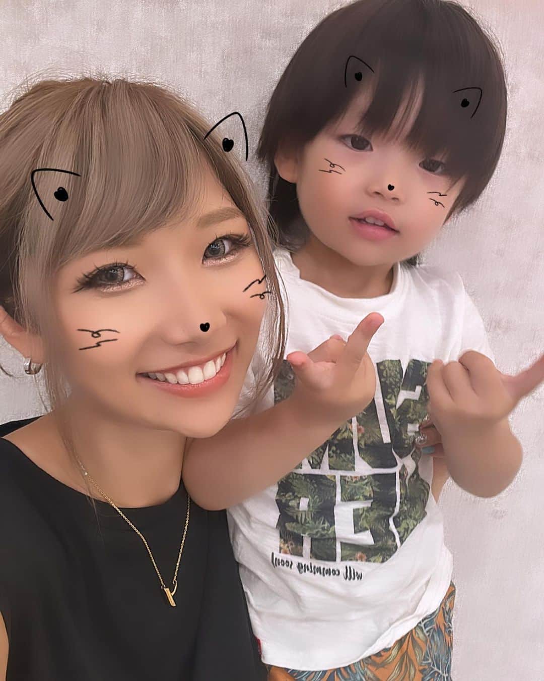 高橋由真さんのインスタグラム写真 - (高橋由真Instagram)「【ケアシス】したら肌の調子 めちゃくちゃ良き！！！！！！  7月上旬に @yunkoro519 ちゃんのクリニック @renataclinic で【ケアシス】を受けてきたんだけど これがめちゃくちゃ良かった🥰✨  電圧で温めながら美容液を浸透＆冷やしながら美容液を浸透させるの⚡️ ザワザワとピリピリとした不思議な感じで痛みはそんなになくクルクルされるんだけ🌀  ダウンタイムもなくて３週間ほど経っても効果を実感してる！！！ ハリ？がある感じで、とにかく肌が綺麗になってるの😳✨  これはまたやりたい施術！！！！  @renataclinic は託児所があるから子連れでもOKなの🙆‍♀️✨ ママにとっても優しいんだ😭❤️ 託児所代は無料でございます！！！！  今度はM22のフォトフェイシャルをやりたいんだな🥺💓 夏が終わった頃にでも予約したいな🫧  お値段も他のクリニックと比べてお安くて、院内は綺麗で託児所もあってスタッフさん優しくて、めちゃくちゃおすすめのクリニックです🏥✨  #美容 #美容クリニック #美容医療 #ケアシス #肌ケア #表参道 #子連れ #子連れエステ #託児所 #託児所付き #子連れ美容」8月4日 19時20分 - yumachi1021