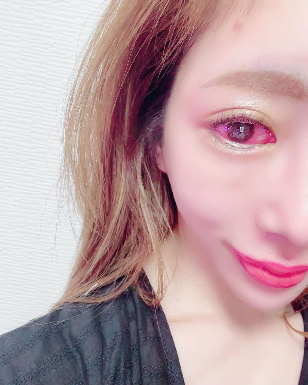 dj..琴のインスタグラム：「そして、、現在全然切開手術とは関係ないんだけど、、、片目死亡．．病院に通ってる。。 コンタクトつけれないし。。 メガネ買い直ししたりとかで。。 まじこの身体のポンコツ具合に腹立つ。。  前回の記事で文字数オーバーして お礼を言えなかったから、、 先生本当にありがとうございました😊  やってよかったって思いました♡  熊本、福岡院もできたみたいで 福岡は50%オフでやってるみたい！！  詳細はよくわからないけど 気になる子は是非！！  琴の紹介だったりこれ見てきたって人は きっと先生がなにかしてくれるはずだから 言ってみてください！！笑  ただね、、きっとほんと どこを明確にしたら良いとか、施術内容をはっきり決めて行くこと大事。  人それぞれ、違うからねー。  ちょっと今目がこんな状態でもあり 全然気持ちが晴れない状態だから この目をまず治して、、 って感じで、、  配信はビゴでしてるし良かったら 見にきてねー  8.13日からきっと大名のところの ビジョンに映るはず。。 あれ違うぞ．．笑 11日からだね？？もはや琴はどこの期間に載るかも知らない。。  詳細聞かないといけないな！！また分かり次第、、投稿すゆ！！  @nagashimaclinicfukuoka  @nagashimaclinic  @nagashima.staff」