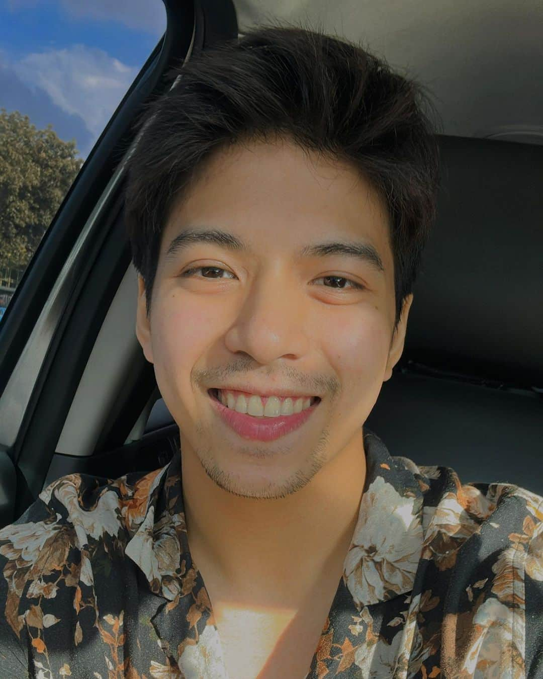 Nash Aguasのインスタグラム：「Braces off! Ecstatic with the result!! Thank you @dentaderm.ph for taking care of me 😘❤️」