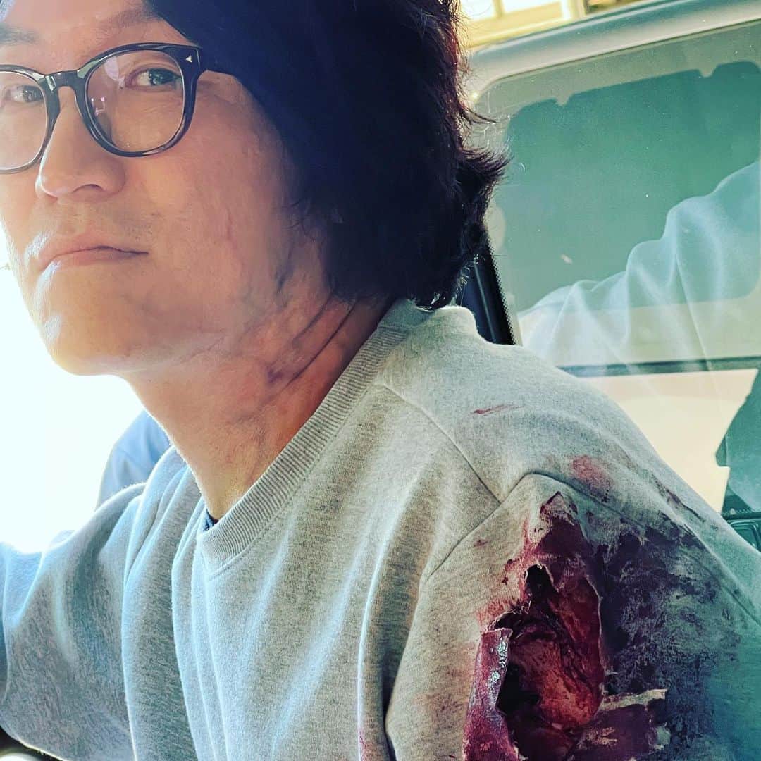 DINDINさんのインスタグラム写真 - (DINDINInstagram)「Welcome to the #Zombieverse 🧟‍♂️」8月10日 12時41分 - dindinem