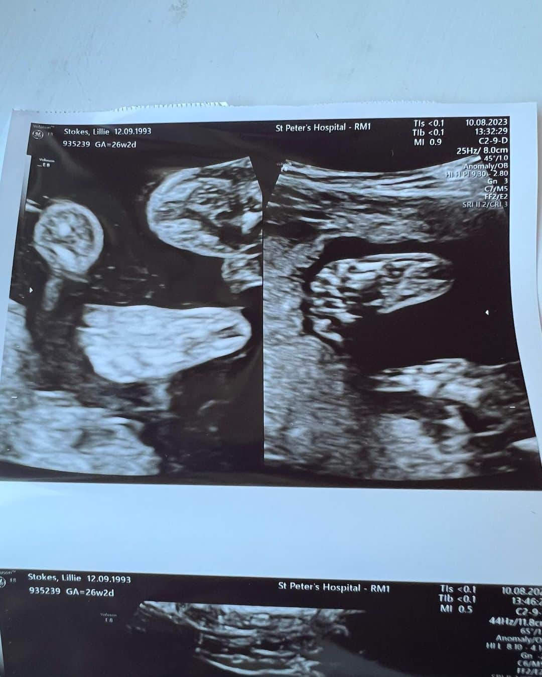 ロス・ディッカーソンさんのインスタグラム写真 - (ロス・ディッカーソンInstagram)「20 weeks pregnant with our baby boy💙 #babylife」8月11日 2時04分 - dickersonross