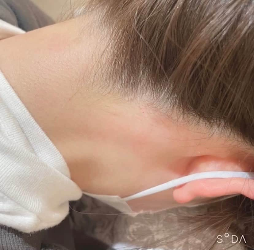 u by KINDのインスタグラム：「うなじWAX(  ˆoˆ ) スッキリするのでアップスタイルも楽しめますよ✨✨  イイネお待ちしております♬︎  #KIND#JBWA#動画#鍵付き#ヘッドスパ#地下#WAX#脱毛#本部認定講師#光脱毛#ルミクス#ダブル脱毛#完全個室#駐車場があるサロン#化粧品検定1級#外苑前#乃木坂#青山一丁目#ヘアサロン#ヘアメイクエイジングトリートメント#南青山#Before#After」