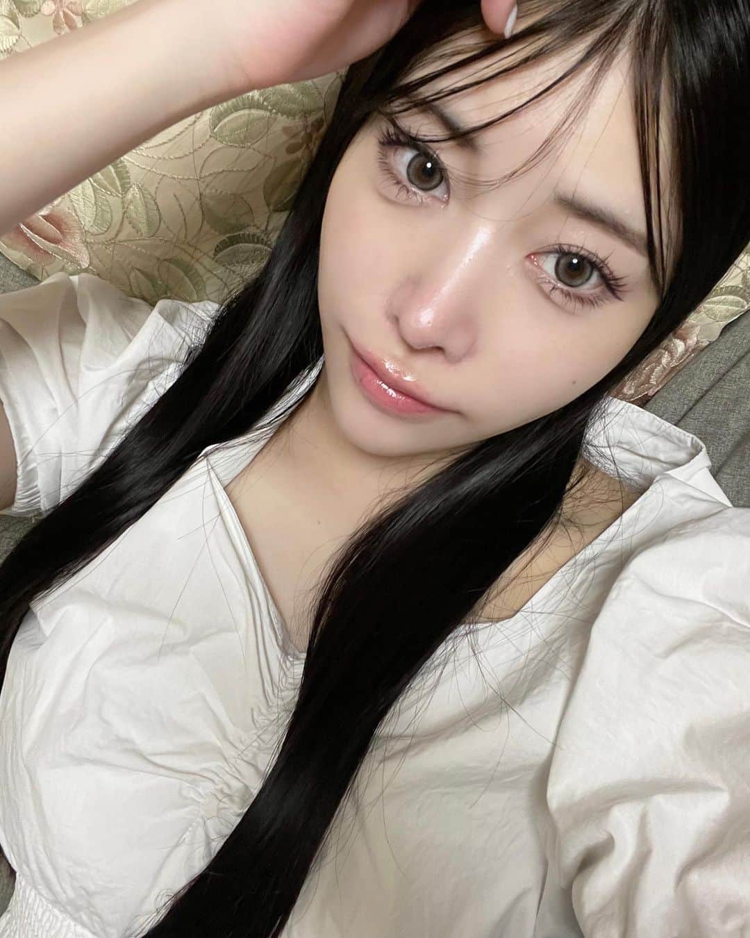 七瀬かれんのインスタグラム：「🩵🪽  TCB式小顔美肌再生の施術をしてもらいました🪡  ノーマルカメラで撮って肌加工だけしたけど 当日のこの写真で見てわかる通り 全然腫れてないし引き上がりがすごい🩵🪽 喘息を持ってるのでカウンセリングでは使用する麻酔についてちゃんと説明をして下さり 安心して施術を受けられました😌✨  🏥東京中央美容外科千葉東口院 @tcb_chibahigashi  🧑‍⚕️根本先生 @tcb_nemoto_naohisa  また経過を載せていきますね💕︎  #pr #東京中央美容外科 #千葉 #糸リフト#小顔整形 #tcb式小顔美肌再生」
