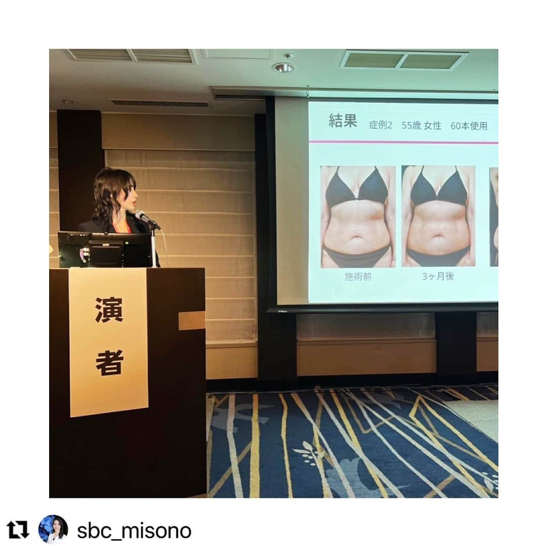 西川礼華のインスタグラム：「#Repost @sbc_misono with @use.repost  SBCグループでは 美容皮膚科医のキャリア形成のひとつとして、 サブスペシャリティを選択し極めることを目標とする 「エキスパートコース」があります。  御園生先生は院長業務の傍ら、学術活動にも取り組み、SBCで痩身治療分野のエキスパートドクターとしての称号を持ってらっしゃいます。  昨年はクルスカ、今年はトゥルースカルプiD、うるコラによるボディのタイトニング治療について学会発表なさっています😌  ・・・  うるコラボディについて学会発表しました！  時差投稿ですが、先日開催された日本美容皮膚科学会で ボディのたるみに対するショートスレッド治療(＝うるおいコラーゲンリフトボディ)について学会発表を行いました。  西川先生、村松先生はじめ、発表にあたりご指導ご協力いただいた方々に感謝申し上げます。  国内だとまだほとんどのクリニックで行っていない治療ですが、これまで私が担当したいくつかの症例を提示しつつ発表しました。  痩身専門院として患者様、お客様のお悩みを解決するために脂肪を減らす治療のみでなく、こういった補助的な治療にも力を入れています。  うるコラボディは現在当院限定メニューですので気になる方は是非カウンセリングにお越しください👩‍⚕️  学会自体は尊敬する先生方のご講演を聞いたり企業展示で目新しいものがないか見てみたり学会じゃないとなかなか普段お会いできない先生方とも話せたりと有意義な2日間でした✨  #うるコラ #うるコラボディ #うるおいコラーゲンリフト #ショッピングリフト #ショッピングスレッド #日本美容皮膚科学会」