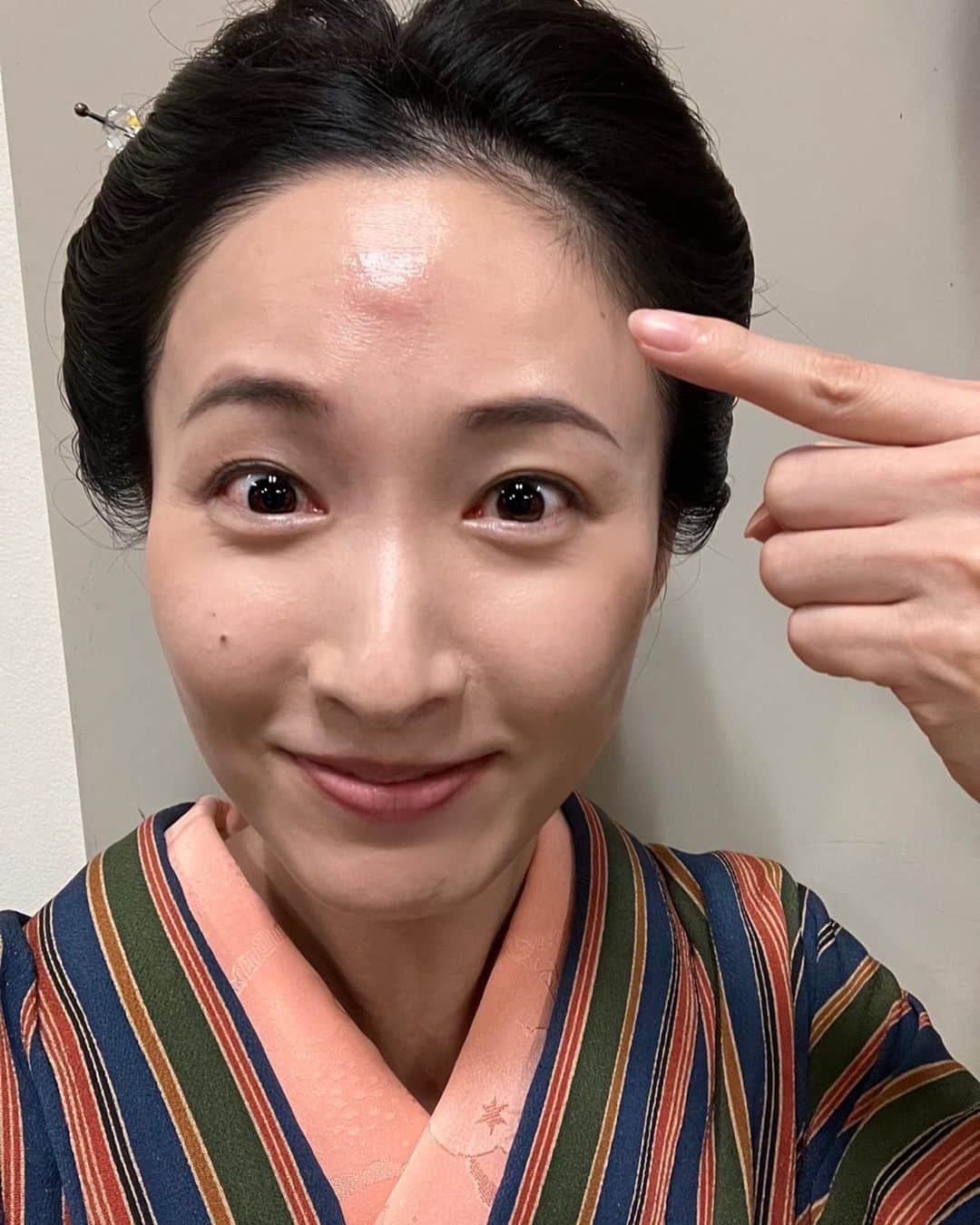 のインスタグラム：「. 今朝は「らんまん」をご覧になられた方から 沢山の連絡がありまして😳 改めて 素晴らしい経験をさせて頂いたと実感した朝です。  来週も楽しみですね🌸  実は，撮影当日。 さ！いよいよ次は私の撮影だ！ というタイミングで まさかの蚊に刺されました🦟 しかも，おでこのど真ん中。  …なんで⁈ これから私映るのに！ 今⁈笑🥺  なんか…おでこ痒いなと思ってたけども！  素晴らしいメイクさんの技術のおかげで コンシーラーで綺麗に消して下さいました😭 感謝です…😭  こんな場所。 蚊に刺されたの人生初。  ということで… これからご覧になられる方。  必死に隠した、蚊の刺された直後のでこ😂 ご愛嬌ということで、 優しく見守って頂けたら幸いです笑🦟  みりおん。 #らんまん #朝ドラ #まさかの蚊に刺される #たんこぶ並み #現場にいた皆さんが思ったでしょう #なぜ今😳 #蚊には気をつけて笑！」
