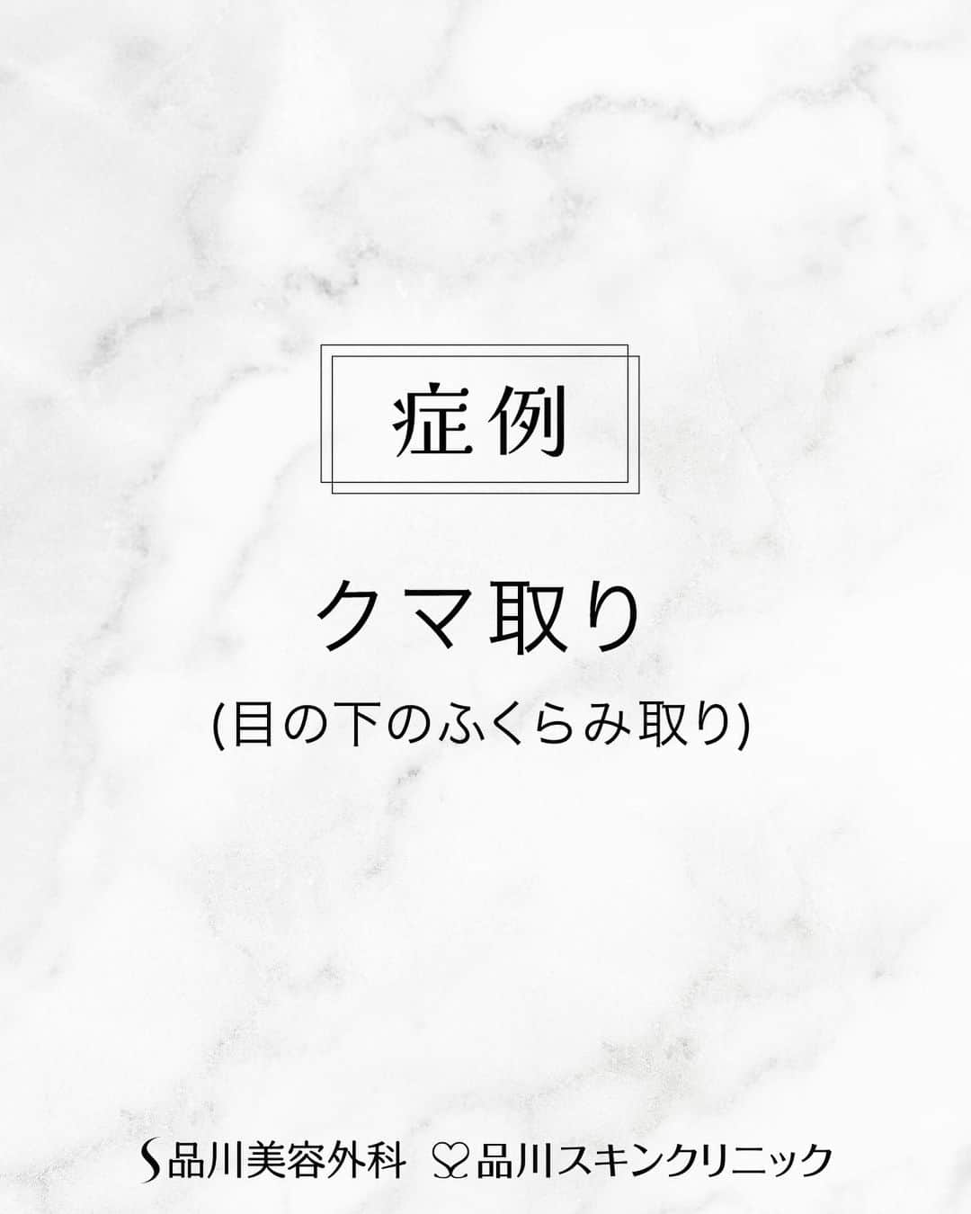 品川美容外科【公式】のインスタグラム