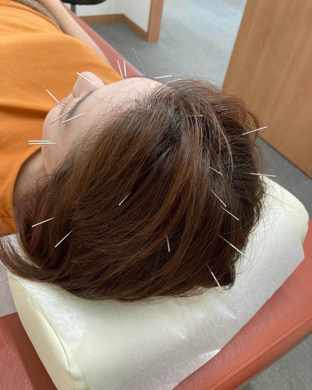 有田優理香さんのインスタグラム写真 - (有田優理香Instagram)「💆‍♀️  新潟帰省ふり返り②  中学水泳部の先輩のはり灸院(@takayama_hari )で 施術していただきました🙏  インスタをフォローいただいてから ずっと行きたいと思っていて！ タイミングが合ってやっと行くことができました😊  パソコン画面とにらめっこしながら仕事することが多くて 目が疲れ切っていたので 眼精疲労に効く鍼治療をお願いしました🌷  初めての鍼治療！ うお〜入ってる〜！って最初は不思議な感覚でしたが、 時間が経つにつれて心地よくなって 終わった時には超スッキリしました！！ 鍼すごーーーー✨✨  懐かしいお話もいっぱいでき楽しい時間でした😆 帰省したらまた伺います！ ありがとうございました🙇‍♀️  #高山はり灸治療院 #新潟鍼灸院 #新潟市鍼灸院 #巻西中学校 #水泳部 #zip #がんばります 💪」9月8日 18時32分 - yurikaa0624