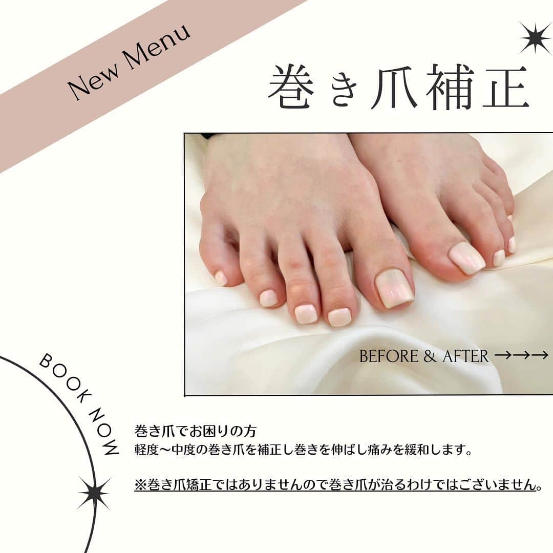 esNAILのインスタグラム：「新オプションメニュー🦶✨✨ ・ ・ サンダルの季節もそろそろ終わりですが 秋、冬になると痛みが増すのが巻き爪。。。🤕 ・ ブーツやパンプスなどつま先が狭い履き物、乾燥により巻き爪の方は痛みが増してくるのではないでしょうか？？ ・ ・ こちらは特殊な器具や道具を使わずに巻き爪のカーブを補正する施術です💁‍♀️ ・ 2枚目の写真でわかるように施術直後かなり巻きが緩くなり痛みも緩和されます！！ ・ 補正後ジェルを塗ることができるので ジェルを楽しみながら巻き爪の痛みも解消できます🎵 ・ ・ 巻き爪で痛みがある方 爪の形が気になる方 ぜひお試しください✨✨ ・ 自然に仕上げることができるのでメンズにもおすすめです！！ ・ ・ ※巻き爪矯正では無いので巻き爪が治る訳ではございません。 ・ ・ 詳しくはスタッフまでお問い合わせください✨✨ ・ ・ #巻き爪#巻き爪補正」