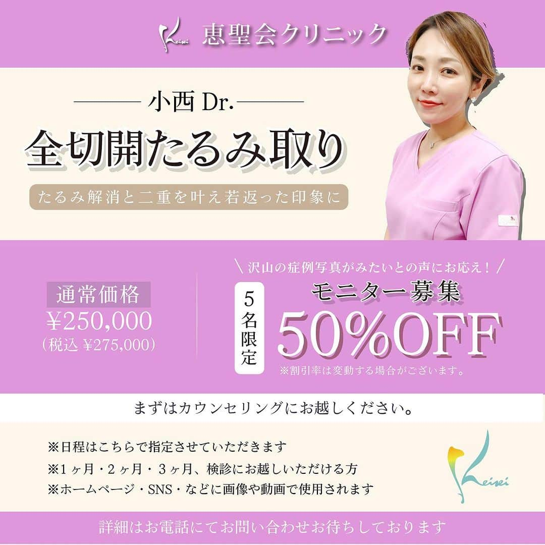 恵聖会クリニックのインスタグラム：「. ＼50%OFFモニター募集／  もっと沢山の症例がみたい！というお声にお応え！！ 50%OFFモニター募集のお知らせです🤍  🔖小西医師による全切開たるみ取り　【~50％OFF】   🔖楠瀬医師によるクイーンリフト　【~50％OFF】   🔖楠本医師による目頭切開　【~50％OFF】   🔖鬼頭雄也医師による全切開法　【~50％OFF】  🔖田川医師による鼻骨骨切り　【~50％OFF】  詳細はお電話にてお問い合わせください🙇🏻‍♀️🫶🏻 ご予約お待ちしております♪  〜〜〜〜〜〜〜〜〜 心斎橋院☎️06-6252-5650  京橋院☎️06-6242-5620  梅田院☎️06-6342-5650 〜〜〜〜〜〜〜〜〜  #全切開 #鼻フル #鼻骨骨切り #目頭切開 #クイーンリフト #モニター募集 #美容医療 #美容クリニック #美容外科 #美容皮膚科 #美容整形外科 #大阪美容外科 #大阪美容皮膚科 #恵聖会クリニック」