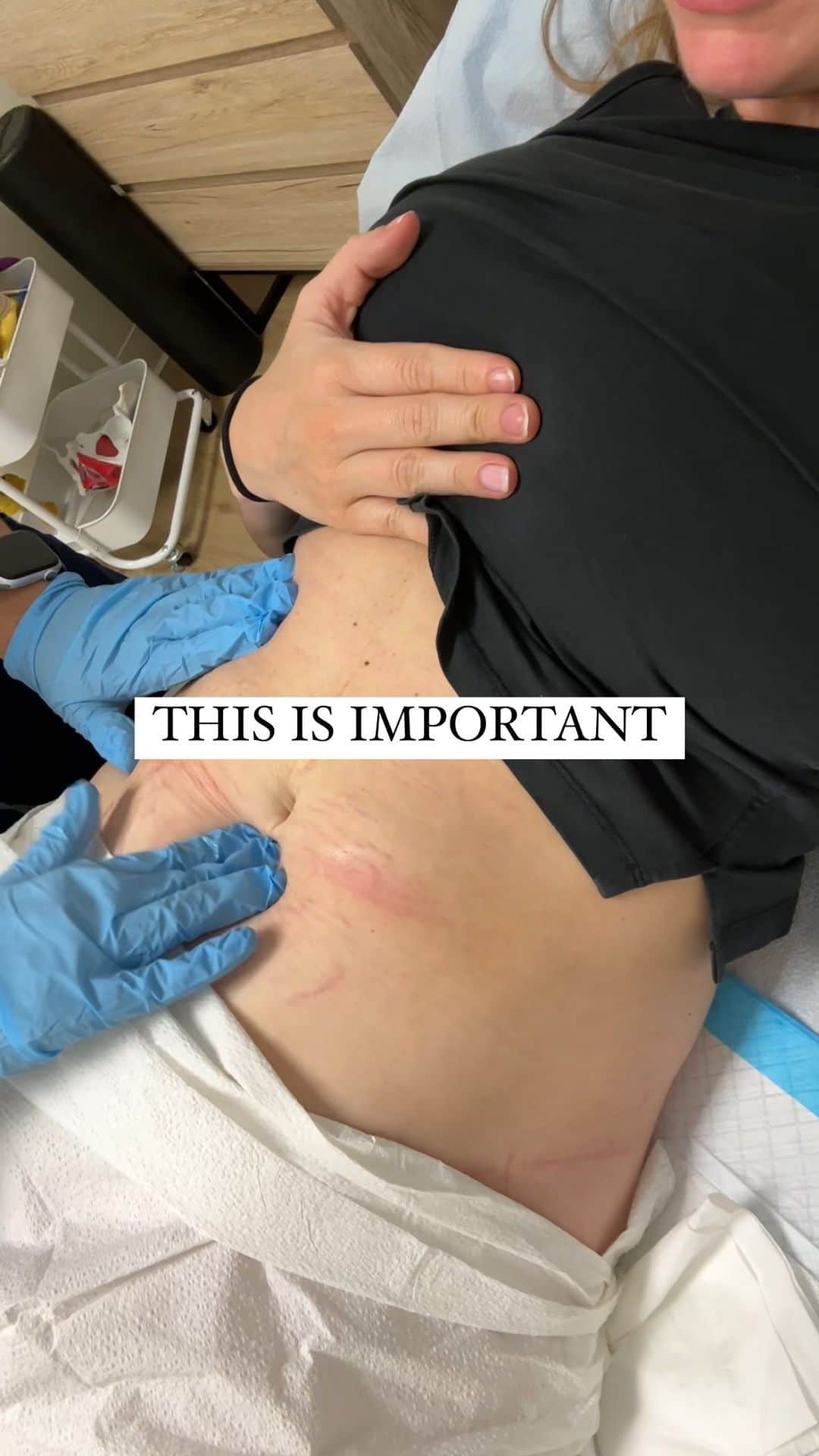 のインスタグラム：「THIS IS IMPORTANT ‼️  Do you know someone who is pregnant or postpartum? If so, tag them!  Pelvic Floor PT is so important YES especially after having a baby, but did you know - you don’t need to have given birth to benefit from pelvic floor PT, and even men can benefit from it?  But since I did just have a baby, here’s what my appointment looked like ☺️🤰  Big shoutout to my PT @ladybirdpt for letting me film and share this with you all! 🙌 give them a follow to learn about all the ways pelvic floor PT can help you!  If you don’t have access to pelvic floor PT, I do have a postpartum program in my @fitbodyapp called Restore Your Core that can at least help repair diastasis recti and is where I recommend ALL my postpartum mamas start when beginning their return to fitness (link is in my bio to try it free for 7 days!)   But for pelvic floor weakness or pelvic floor tension and issues that can arise from either of those things (like incontinence, prolapse, constipation, sciatic pain, pain during intercourse, and SO much more) you really need hands on manual therapy from a Pelvic Floor PT or OT. You will likely need to ask your OB for a referral.   Since having baby #1 and speaking about the importance of pelvic floor PT (3 years now) I’ve received several DMs from women saying they went to pelvic floor PT because of me talking about it, and that it has changed their lives 🥺   It’s SO amazing to hear but also frustrating that this isn’t standard postpartum care at the moment, so PLEASE don’t be afraid to advocate for yourself!! ❤️  #pelvicfloorpt #postpartum #pregnancy #fbgcommunity #annavictoria」