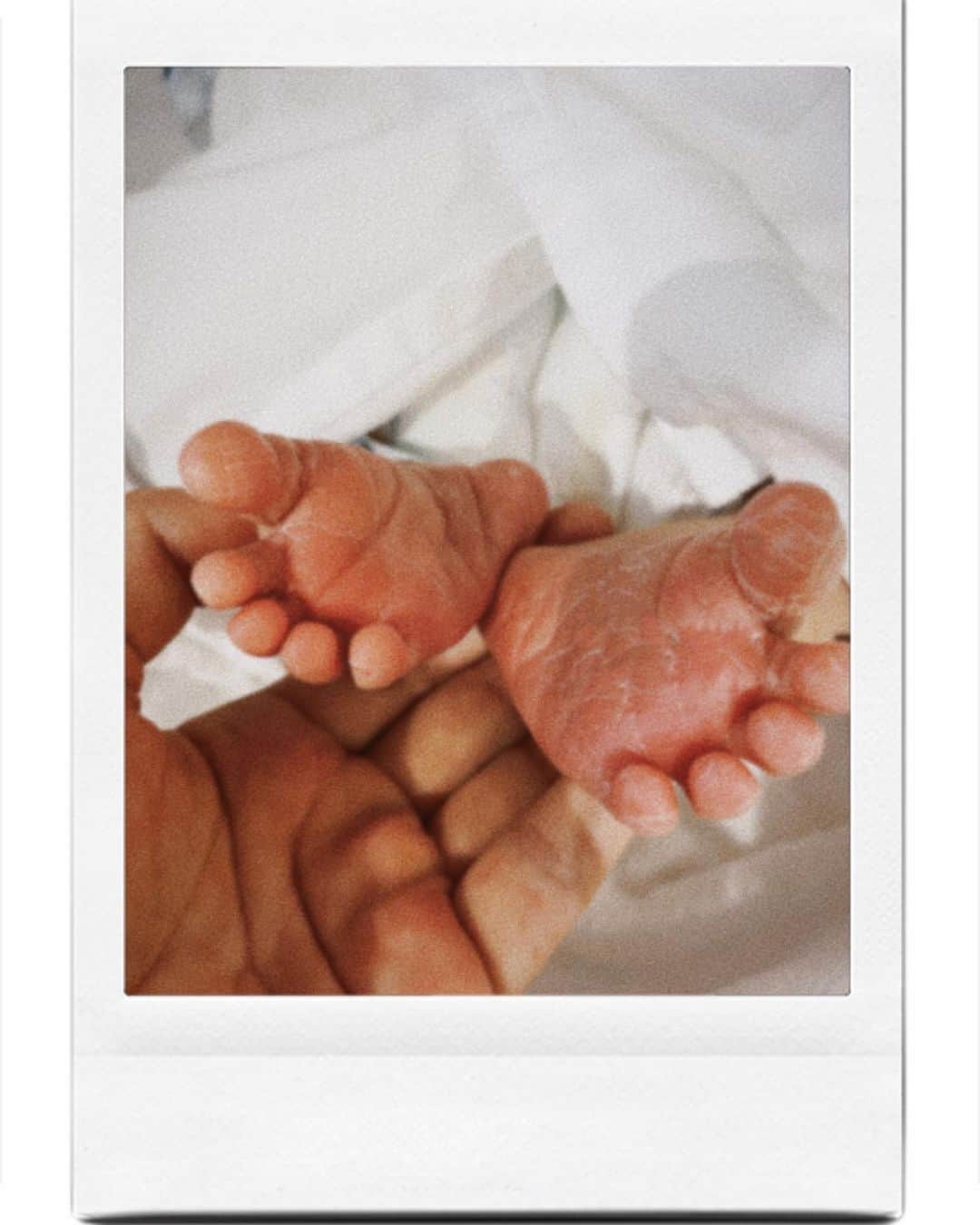 伊藤沙織のインスタグラム：「【Our little girl has arrived】  We welcome with love our baby -August, 2023 -3656g, 50cm  Welcome to the world, little one👶🏻 Your first cry is a remainder that you have arrived,and your journey has just begun!  ご存知の方も、お気づきの方も、そうでない方も、、、ご報告です🕊 実は先日、女の子の赤ちゃんを出産しました👶🏻🤍  予定日を4日過ぎて早朝、ちょろちょろ破水から始まり病院に向かって即入院。 入院してから48時間以上陣痛が来ず、陣痛誘発処置(産科の処置で一番痛いらしい)。  その24時間後に陣痛促進剤を投入するも、なかなかお産が進まず、無痛分娩の希望からの帝王切開に切り替えて出産。  手術中に出血が止まらず、1.5リットルほどの出血性ショックにより寒気と嘔吐が続いたので輸血判断。(普通の人の3倍以上出血でした🩸)  病院から夫に手術説明の電話。(立ち会い不可の病院の為) 1時間ほどで無事に帝王切開終了。  終わってしばらくして家族と面会できてひと安心しました！  希望していた無痛分娩は叶わなかったけれど、何よりも無事にうまれてきてくれて、産声を聞いた時には味わった事のない感動で涙でぐしゃぐしゃ、、、😭🕊 私たち夫婦のもとにうまれてきてくれてありがとう、よく頑張ったね😭😭😭🤍  そして全世界のお母さんたち、尊敬🥹 陣痛が来るまでは余裕こいてたのに始まったらそれはそれはもう何しても痛すぎて悶絶！！！！でした！ 今は傷口が痛すぎてトイレに行くまでも子鹿のような足取りです笑  お世話になった病院の方々にも感謝です🥲 1日投与できる陣痛促進剤の量が終わり、 ・仕切り直して明日また促進剤を入れる ・帝王切開に切り替える の二択の判断で、 帝王切開に切り替える選択をした時に 「ここまで良く頑張りましたね」 「勇気いる決断だと思います！」と声を掛けていただいて自分の決断に自信が持てました。 都度、気にかけてくださったおかげで安心して出産に臨む事が出来ました！  どなたかの献血のおかげで、こうして産後の回復も順調なので私も落ち着いたら絶対献血行こうと思ったけど、輸血した人は出来ないと知ってガーン😩 代わりに夫に行ってもらおうと思います🥺💉  出産までがゴールではなく、これからがスタートだと思うので家族力を合わせて頑張ります🥺💓  思いが書ききれないので、また出産までの道のりや妊娠中の事など投稿が続くかと思います✍️  妊娠中、直接お伝え出来た方や お会い出来なくて突然のお知らせになってしまった方も、、  取り急ぎご報告まで🕊🤍  #babygirl #birthannouncement」