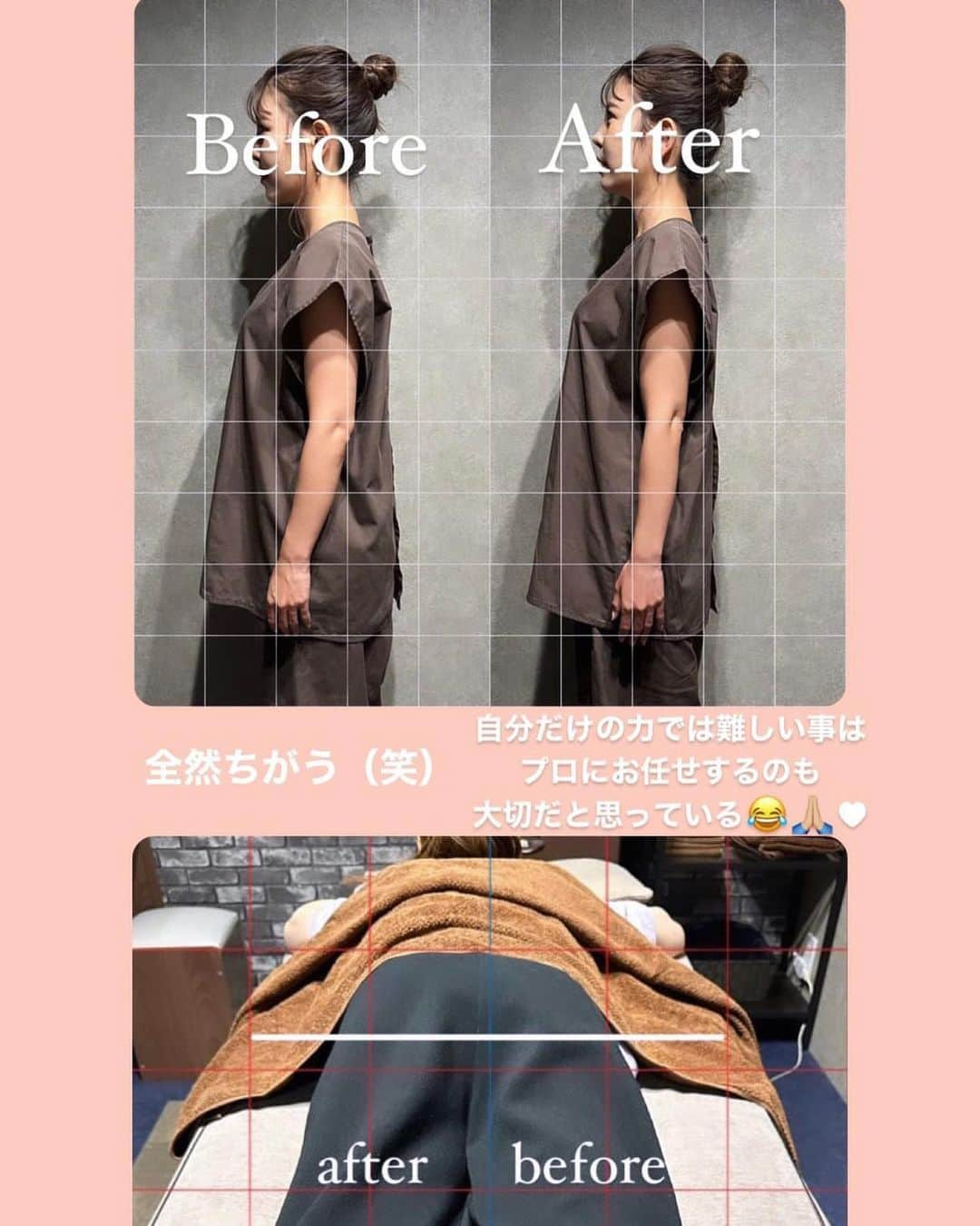 岩下えみさんのインスタグラム写真 - (岩下えみInstagram)「⁡ ⁡ ⁡ 今月もココロビさんへ 行って来たよぉん*.⋆( ˘̴͈́ ꒵ ˘̴͈̀ )⋆.* @cocorobe_official  ⁡ ⁡ フェムケア矯正からしてもらったよ‼︎ 前回に引き続き 身体の土台を整えてもらうよ🌼 PMS、生理痛があるのは もう当たり前じゃないと学んだので 是非とも無くしたい🤭 ⁡ 全く痛く無い施術やのに 整うのって凄いよね✨ 姿勢もシャキーンってなってる😹 ビフォーアフター見てみてね♥︎ @cocorobe_toshiki  いつもありがとうございますᐠ( ᐢᐢ )ᐟ ⁡ ⁡ そして 安定の美乳鍼＋DiNaメニュー👙 美乳鍼で全身を整えて トリートメントしてからの DiNaで美容液導入🩵🩵🩵 夏はどうしてもホールド力が 無いものを身につけるから ケアしてあげないとすぐ ハリ無くなって盛れなくなるから ケア大切すぎる😂🙏🏼 ⁡ 今回も元気取り戻してくれた〜♥︎ ⁡ ⁡ いつもありがとうございます*.⋆( ˘̴͈́ ꒵ ˘̴͈̀ )⋆.* @cocorobe_official  @cocorobe_yasu @ryota_kubo.9d  @cocorobe_toshiki  ⁡ ⁡ ⁡ 𖥣大阪府大阪市北区曾根崎１丁目２−８ マルビル 5階 （JR大阪駅御堂筋口より徒歩8分/JR北新地駅より徒歩6分） ⌚︎11:00～20:00最終受付 ⁡ ⁡ #パーソナルトレーニング #cocorobe #ココロビ #DiNa と#無針水光注入 #無針水光注入dina #dina育毛 #dinaバストアップ #梅田エステサロン#ヒト幹細胞培養液 #ヒト幹細胞 #梅田バストアップ #北新地バストアップ #バストアップサロン #美乳鍼 #無針水光注入 #無針水光注入dina #dinaバストアップ #バストケア#美容液#バストマッサージ」8月18日 1時44分 - emii114