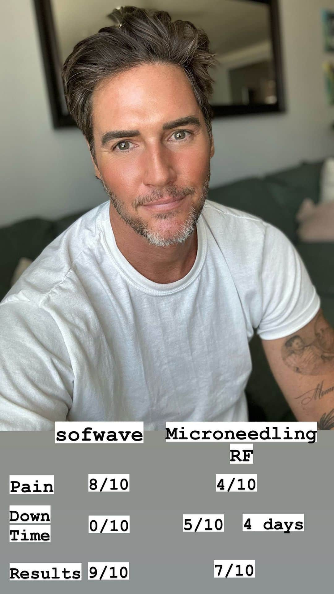 ポール・ノートンのインスタグラム：「I’ve been on a bit of a skin journey the past couple of years and I want to share my most recent adventure to help boost my appearance, #microneedlingrf that I received from @drjohnshieh at his practice in Pasadena @rejuvayou where I also received @sofwavemed from @victoriazbruce not too long ago! I’m still seeing subtle changes in my skin from this recent treatment but so far I’m thrilled with the results! I absolutely loved the #sofwave as there was amazingly results for tightening with zero downtime, however it is a bit of a spicy treatment, but well worth any discomfort as you are nicely numb. The Microneedling RF was in my opinion much more tolerable but did have several days of not so beautiful downtime, but again well worth it! With Sofwave you are pretty rejuvenated after only 1 treatment, once or twice a year where as the Microneedling RF may require a few. I think regardless which option you choose I know that the rewards will be pretty great and you will thank yourself in the long run! How lucky are we to live in a time where technology can really work wonders to help us age our best! Thank you so much to all the incredible staff of @rejuvayou for helping me feel more confident! And of course a huge thank you to @melissabenyoseph / @kelzpr for turning me on this this magic I’m the first place!」