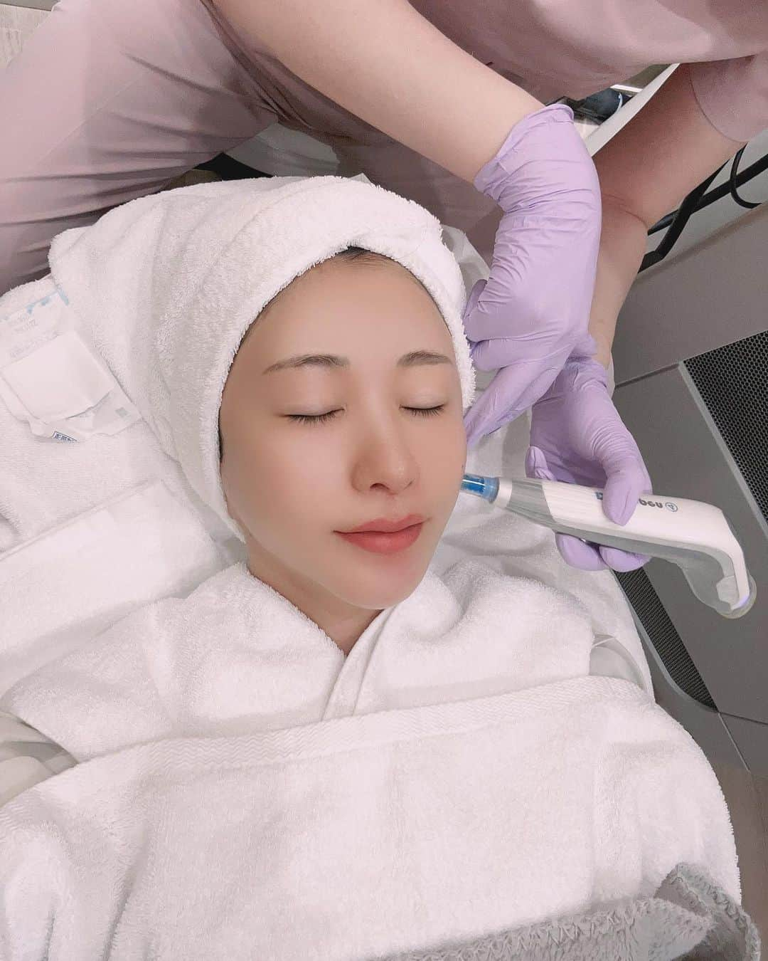 中村江莉香さんのインスタグラム写真 - (中村江莉香Instagram)「#美容撮影 📷💆‍♀️ 大切な撮影が週末から続くので... 今だ‼️と思い#ダーマペン4 ➕成長因子して来ました💉⚠️ #絶賛ダウンタイム 突入🤕🩸  #肌治療 は昨年10月に#ポテンツァ をしたぶりです🏥 ホームケアをこつこつしながらも、毛穴の開きと肌のハリツヤの衰えを感じて#ダリア銀座スキンクリニック へ🥹🩷  #ダリア銀座 のドクターはカウンセリングがとても丁寧で安心して施術が出来る♡♡ 私は肌が薄いので、レーザー治療をすると肌の赤みが増えたり、肌が弱くなってゆくのを感じるので、針を使う施術が合っている🤔‼︎ (私は混合肌で鼻や顎は皮脂が多く、頬や額は乾燥気味です🤫) 詳しくレポートはブログに書きます📝  @dahliagsc ☜私の投稿を見ました！と、お伝え頂くと初診の施術が1割引きでご案内してくださるそうなので、気になる方は是非行かれてみてくださいね🫶  #美容撮影📷 #肌管理 #エイジングケア #ダリア美肌 #スキンケア #美容皮膚科 #ダーマペン #美容外科 #美容皮膚科 #美容 #美容整形 #美肌 #beauty #クリニック #美魔女 #ニキビ #若返り #モニター募集 #美意識 #肌質改善 #ニキビ跡 #たるみ #モデル #ビタミンc」8月21日 15時21分 - erica_nakamura