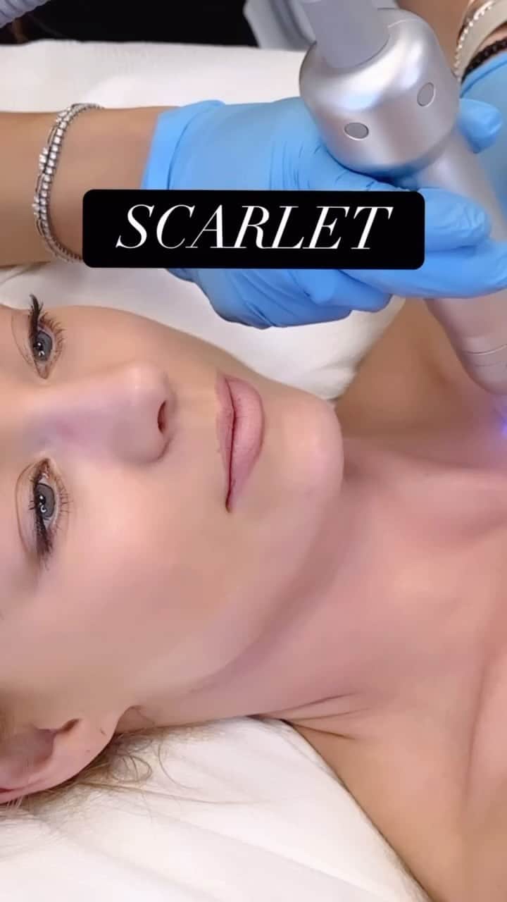 Nikki Leighのインスタグラム：「Not only is SCARLET an incredible treatment for your face, it can be used to address skin concerns all over your body!   Our gorgeous client @missnikkileigh wanted to treat fine lines on her chest, contour her jawline, as well as address a scar on her shoulder. This cutting-edge treatment works wonders to rejuvenate and tighten the delicate skin on your chest, neck and jaw, giving you a youthful and radiant appearance like never before.  By utilizing radio frequency technology, this innovative procedure stimulates collagen production deep within the skin layers, promoting natural healing and tightening effects. ✨  In addition to the overall benefits of Radio frequency paired with micro needling, the tiny, ultra-fine needles create micro-channels on the skin’s surface, allowing for better absorption of our nourishing RE|PAIR stem cell serum, enhancing the overall effectiveness of the procedure.  We’re so excited to chronicle Nikki’s journey with Scarlet and share her amazing results! Stay tuned!   Call to schedule your SCARLET sessions (310) 273-3344 🌟 and ask about our incredible packages available! 3-6 treatments are recommended for optimal results!」