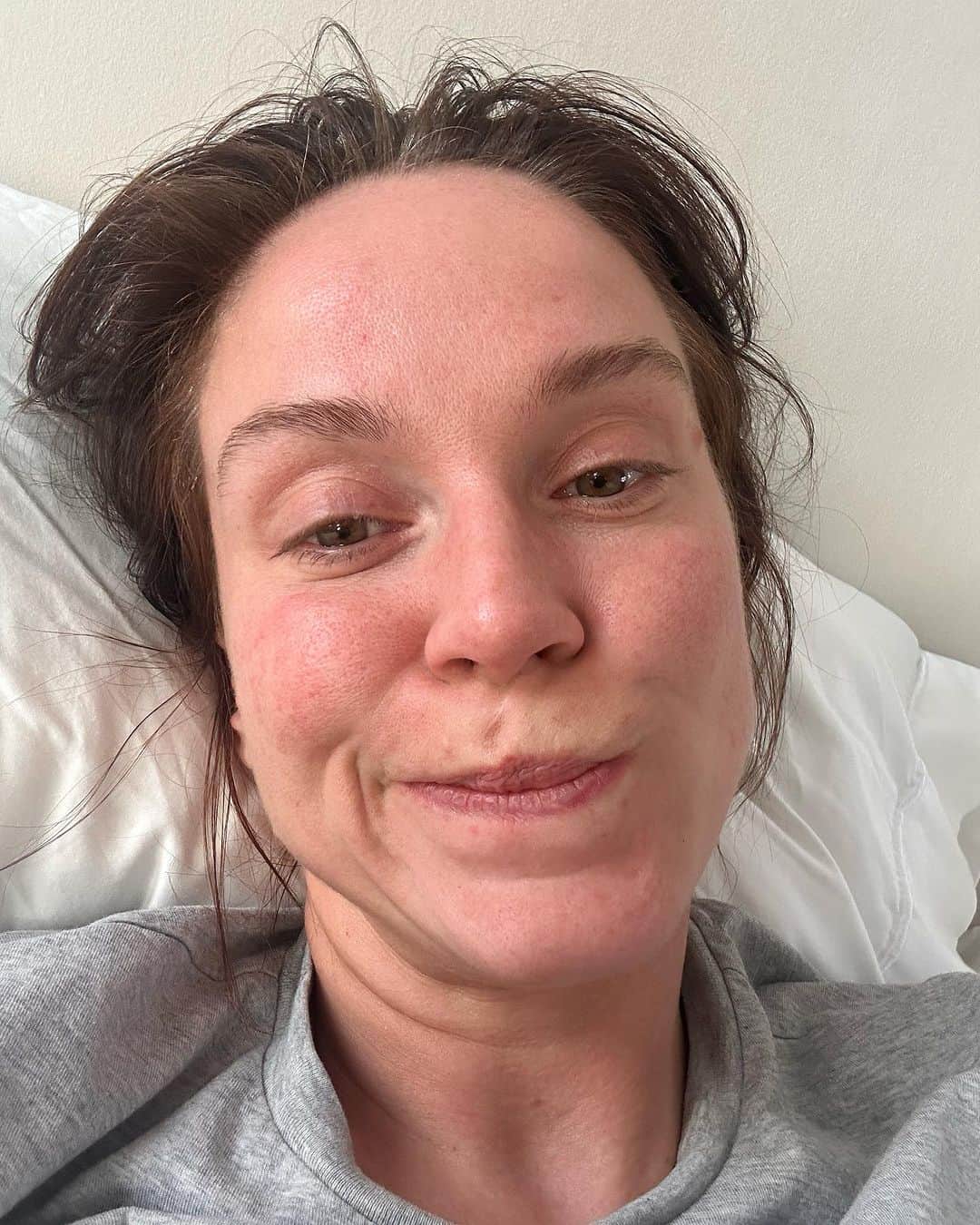 ヴィッキー・パティソンさんのインスタグラム写真 - (ヴィッキー・パティソンInstagram)「I have struggled with my periods my whole adult life- but over the last 5 years or so my PMS symptoms have been completely out of control- it has affected my relationships, my work & my quality of life. At times, it made me feel like I was going insane- I just do not recognise myself for 2weeks of the month & ever so gradually- that time frame is becoming longer- & sometimes, when I'm proper in the midst of this & totally consumed by my own dark thoughts I convince myself that I'm never going to get better.. that these feelings & thoughts aren't temporary. That this is who I am now. And that terrifies me.  For years I have been to see doctors & spoke at length about my concerns & in best case scenarios I was pacified- repeatedly told: 'let's take out your implant', 'periods do get worse as women get older', 'that will be your cyst' etc.. & in worst case scenarios I was made to feel like I was hysterical & unable to deal with the physical & mental ramifications of a period like every other woman could. I was made to feel weak. And I felt embarrassed that I was making a fuss when everyone else seemed to be ok 🥹 So I would leave & I vow to take it on the chin.  But the last couple of months have made me realise I can't go on like this- I'm getting married to the most amazing man, I have the best family & friends & a job I love- and yet i still spend half the month lost. It's like my brain hates me- I am depressed, despondent & hopeless & have no interest in things that usually bring me so much joy.. and trying to not only deal with that but hide it all from everyone has left me exhausted & overwhelmed.   This week I decided enough was enough and went private & told myself I wouldn't be dismissed. When the doctor said to me 'it sounds like you have PMDD..' I cried. I cried because I felt f**king heard in a medical setting for the first time in years and also I cried because hopefully now I can start trying to manage this rather than just 'get on with it'- like I feel like women are expected to.   For the first time in ages.. I feel more positive 🥹♥️  For anyone else struggling with PMS symptoms & wanting to know more about PMDD, please head to my insta story ♥️」8月22日 23時14分 - vickypattison