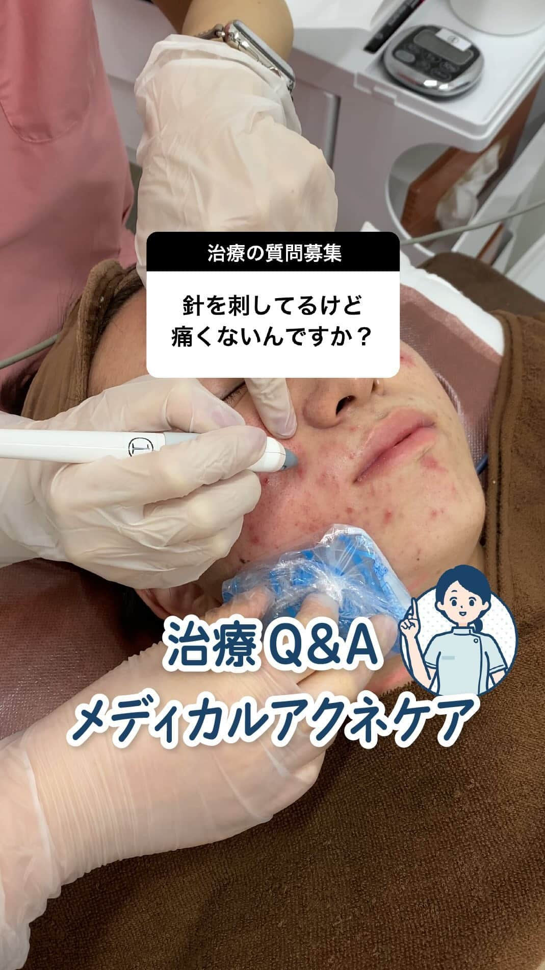 東京アクネクリニックのインスタグラム：「今回はDMでご質問いただいた内容をお答えします！ お肌や治療の疑問があれば、お気軽にDMでご質問ください✨  ∴‥∵‥∴‥∵‥∴‥∴‥∵‥∴‥∵‥∴  アクネクリニック｜ニキビ・ニキビケア  @nikibi.c  他の投稿もぜひチェックしてみてくださいね🥰  ∴‥∵‥∴‥∵‥∴‥∴‥∵‥∴‥∵‥∴ #ニキビ治療　#メディカルアクネケア　#ニキビケア #ニキビ改善」