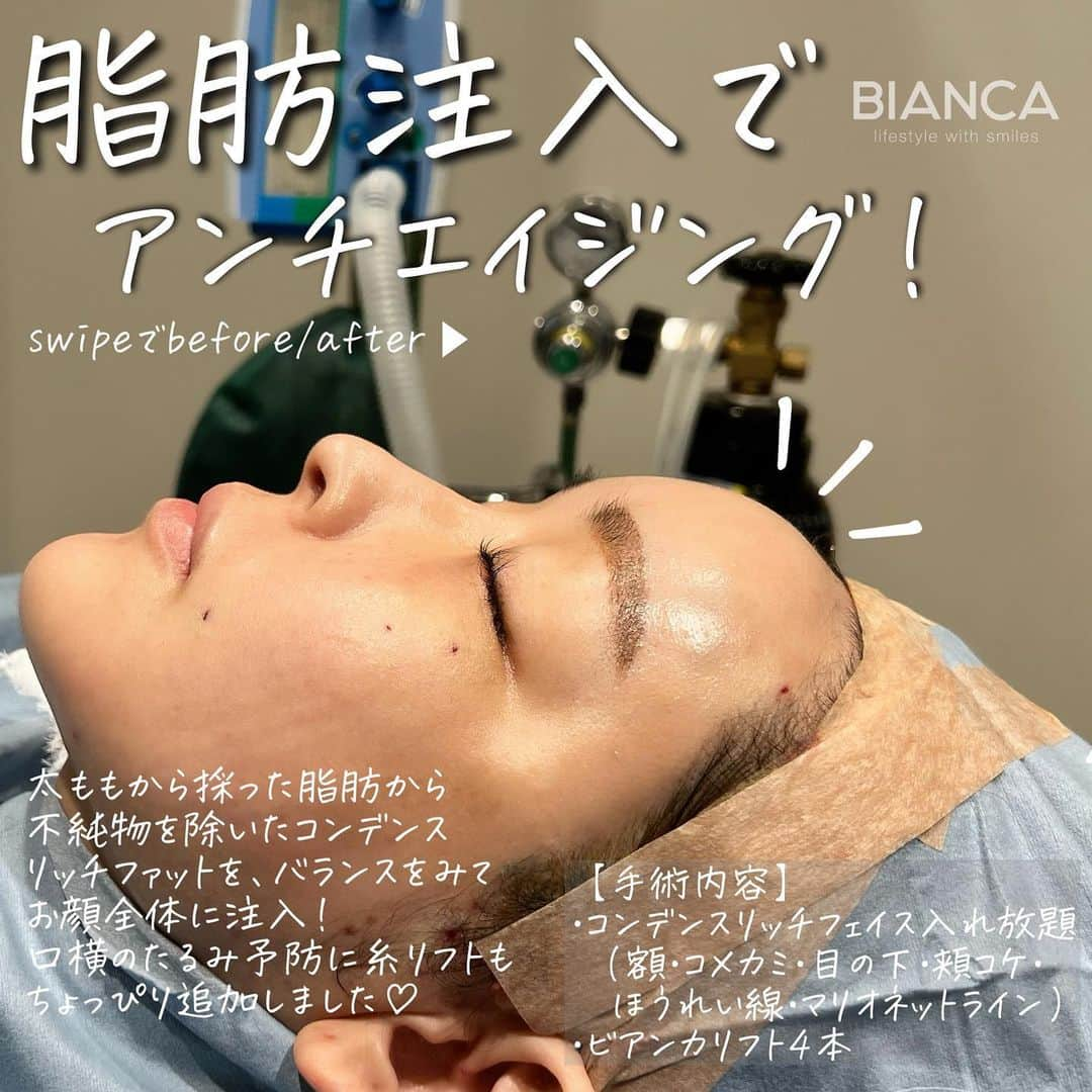 辻沢由有（BIANCA CLNIC 表参道院 院長）のインスタグラム