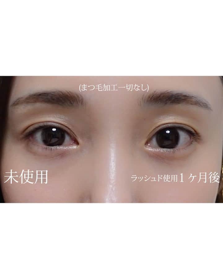 森ニーナのインスタグラム：「口コミでめちゃ伸びると話題のラッシュド！！ ついに私も1ヶ月間、検証がてら片目のみ、毎日塗ってみました 🥹   比較の画像/動画で見て頂くのが早いのですが、めちゃ綺麗に伸びてません？！ 約1ヶ月で2ミリ程伸びました！ 市販でこれは効果が出るには早すぎません？  あえて元々短かった方だけ塗ってみたのですが、元の長かった右目よりも伸びてます😭 感動✨  こういったものでかぶれたり、かゆくなっちゃったりするタイプだったのですが これはたっぷり塗っても肌についちゃっても私のお肌には大丈夫でした 🥹 🙌 心配してた色素沈着も問題なくてひと安心、、  でもちょっと高い？？と思ってたのですが、大容量で一日2回(私は朝と夜)使って3ヶ月もつらしいのでコスパはまあ良い方かも？？  30代突入してからマツエクやらまつパのツケがまわってきて悩んでいたので、毎日せっせと塗ってみてよかった😭笑  良かったら皆さんも試してみてね 😍  #ラッシュド #まつげ美容液 #lashould #まつ毛美容液 #PR」