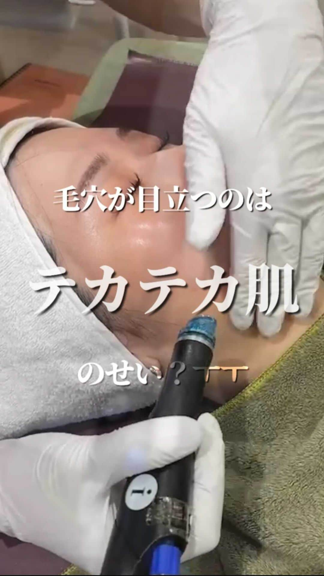 オラクル美容皮膚科東京新宿院のインスタグラム