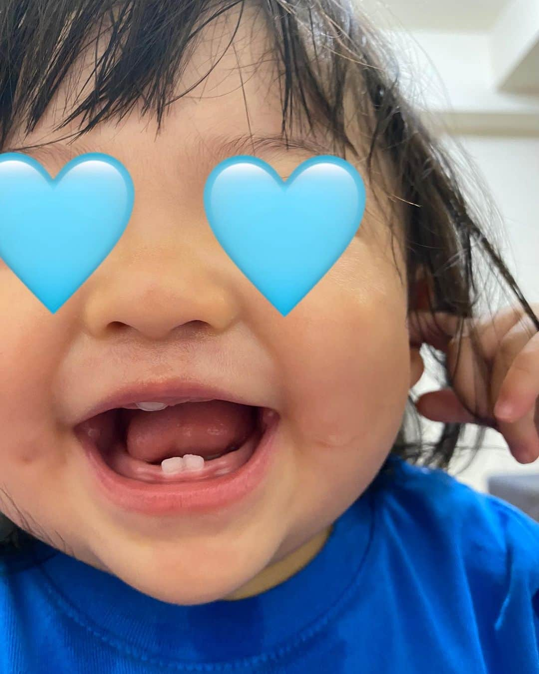 結花子のインスタグラム：「歯さんこんにちは💞 １歳２ヶ月にして、やっと生えてきてくれた娘の前歯ちゃん🦷💞  これからいーっぱい美味しいもの食べようね🦷💞  とにかくよく食べる子なので出来れば早く全部生えてきて〜🥺 . #娘　#1歳2ヶ月  #乳歯　#はじめまして #こんにちは　#これからよろしくね #愛娘　#可愛い　#love #cute」