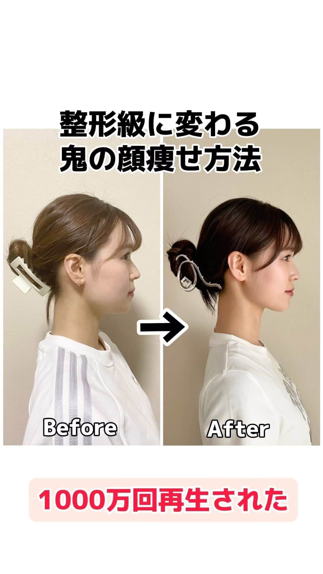 のインスタグラム：「【保存】して一緒に頑張ろう🔥 更に可愛く綺麗になる！！って人は コメントで『🙋‍♀️』送って〜！いいねして 皆んなを通知で呼んで行きます😎  顔痩せ成功コメント続出して1000万回以上 再生されてる鬼の顔痩せ😭✨ いつも一緒に頑張ってくれてありがとう🥹 小顔は作れる！！！！ #ダイエット#ダイエット方法 #ダイエットメニュー  #ダイエット仲間募集 #ダイエット生活  #痩せる#痩せる方法 #垢抜け#顔痩せ #小顔#トレぴな#トレぴな顔痩せ」