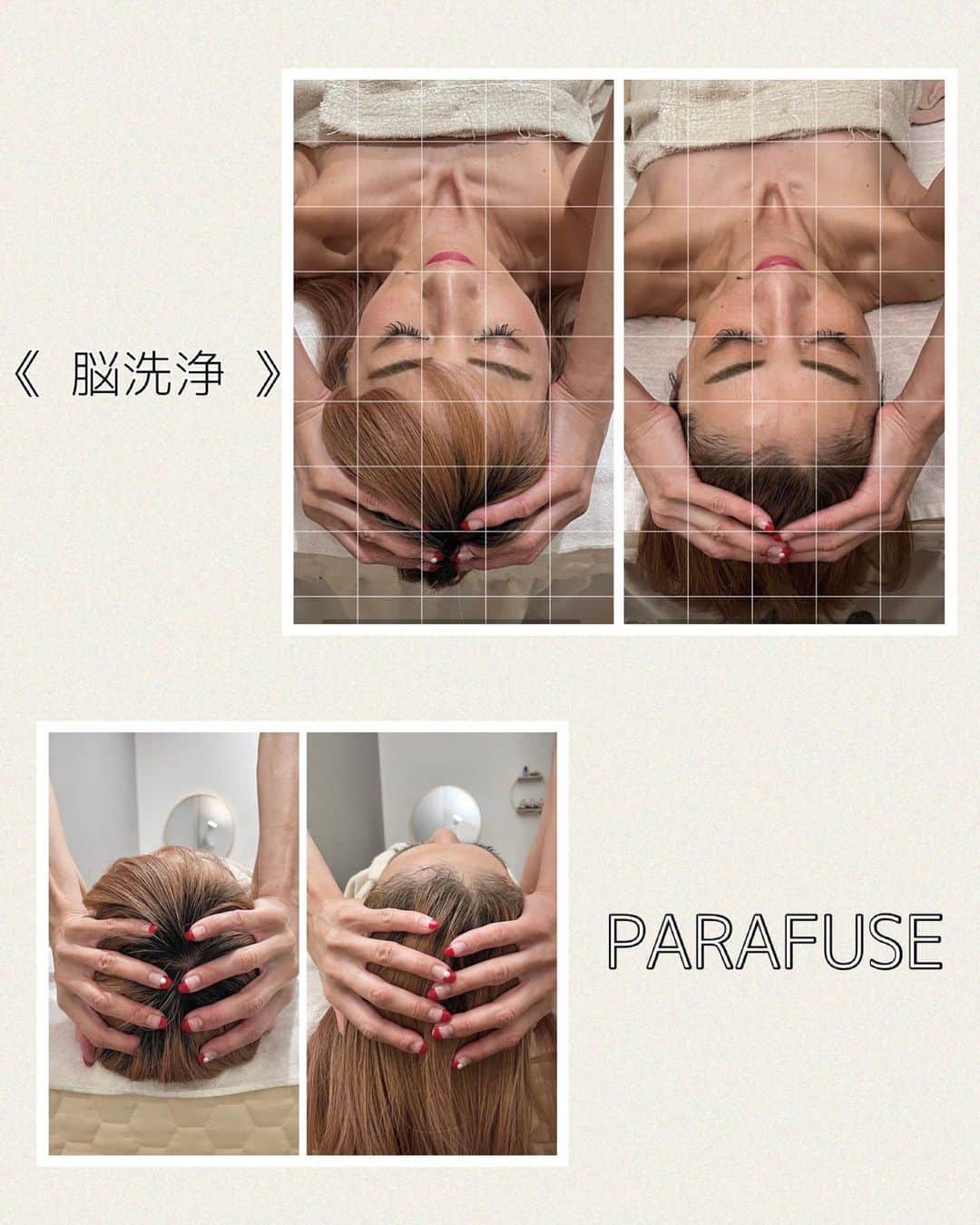 彩耶さんのインスタグラム写真 - (彩耶Instagram)「✳︎✳︎ 週1 通ってる #脳洗浄 〜💆‍♀️✨  一PARAFUSE. 神戸北野 一 @parafuse.kobe.mina   今回で4回目♡  本当にね、今の " 心 " と " 身体 " 両方に 変化を実感しています☺️ 内側から喜んでる感覚〜✨💕  継続して施術してもらって本当に良かったなぁって…😌✨ 初めの4回は週1ペースで💆‍♀️その後は月1メンテナンス〜✨という通い方がもっとも効果的だそうです♡  ⠀⠀⠀ ⠀⠀ 看護師をされていたセラピストの𝑴𝒊𝒏𝒂さん👩‍⚕️の施術は、信頼しかないです💕  お写真𝕊𝕨𝕚𝕡𝕖▶︎▶︎ してね  幻想的な空間の中での施術は、極上の癒し〜💙✨ 足先から首・肩・腕・頭・お顔… 全身をゆっくりと解し、凝り固まった筋肉や皮膚の緊張を緩め、脳をリラックスさせてくれます💆‍♀️✨   before.afterも見て毎回びっくり🤭 もちろん目に見える効果だけでなく、自律神経を整えあらゆる身体の不調改善に繋がるそうなんですよ！ ⠀⠀⠀ ⠀⠀ ⠀⠀⠀ ⠀⠀ これからも月1メンテナンスで 継続していくことにしました💕  気になる方は是非Checkしてね👇 @parafuse.kobe.mina ⠀⠀  ༶༶༶༶༶༶༶༶༶༶༶༶༶༶༶༶༶༶༶༶༶༶༶༶༶༶༶༶༶༶༶༶༶༶༶༶༶༶༶༶ #脳洗浄 #PARAFUSE #パラヒューズ #PARAFUSE神戸北野 #パラヒューズ神戸 #小顔脳洗浄 #小顔 #小頭 #小顔調整 #オールハンド #浮腫み解消 #自律神経 #健康 #美容 #癒し #モデル #ウォーキング講師 #kobe #神戸 #三宮 #北野」8月28日 20時06分 - 3aya11