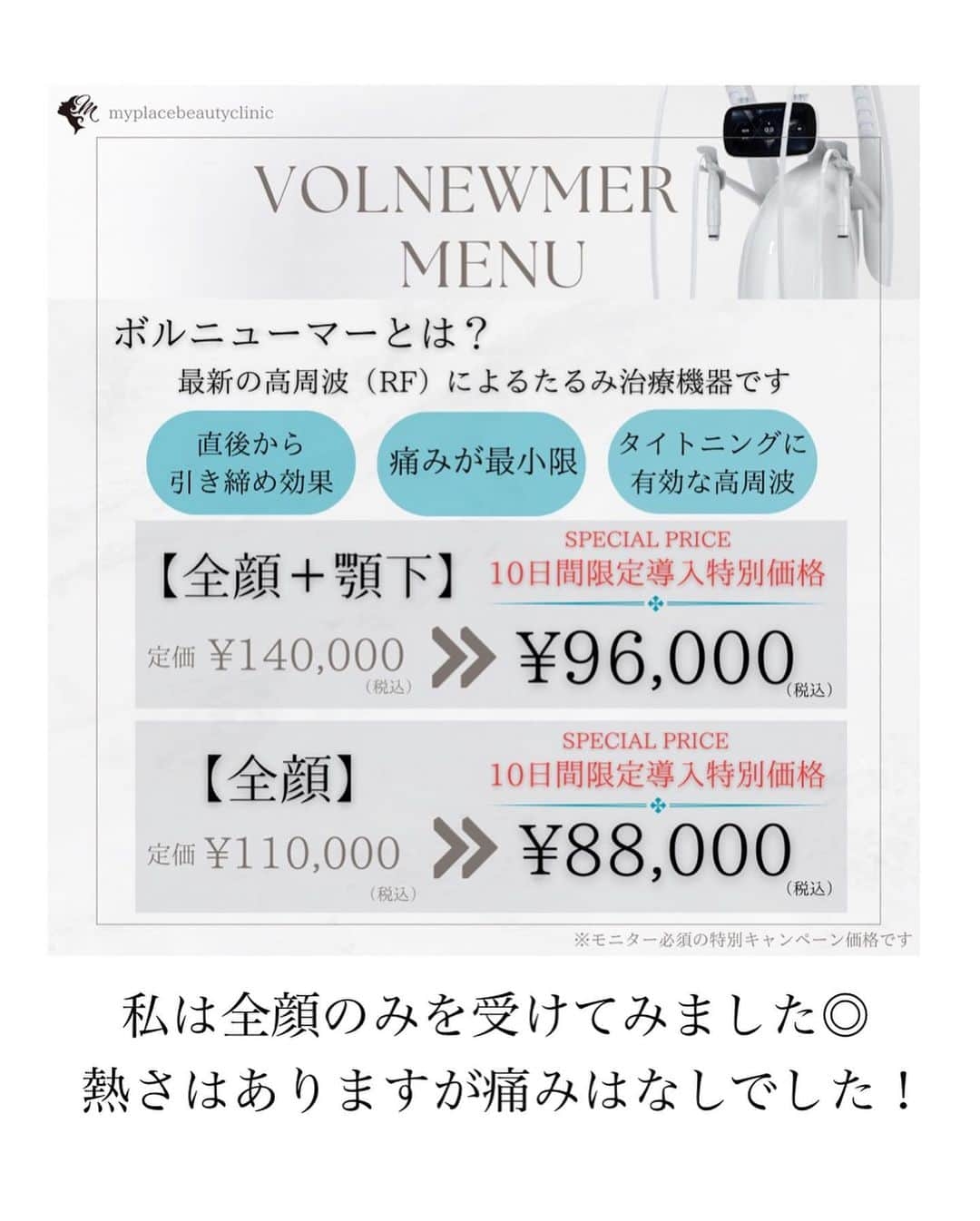 青山日和さんのインスタグラム写真 - (青山日和Instagram)「ストーリーにも載せた美容施術レポ✍️ 遅くなりごめんなさい！ 　 正面より斜めからや横から見た時に たるみが気になってきた最近… 　 ハイフも好きでやってきましたが ハイフのやりすぎはコケに繋がるので 代替案ないかなぁ…と探していたところ 　 いつもお世話になっている @myplacebeautyclinic さんが #ボルニューマー という新機器を入れられた とのことで行ってきました🙏🏻 　 ボルニューマーは 表面の引き締めに効果的な施術で、 例えば私のように お肉や肌が柔らかいことによって たるみやすい人や 　 顔のお肉はあまり減らしすぎたくないけど たるみ治療したい、って人には おすすめなのかな？という感じ。 　 正直 年齢を重ねていく上で顔が 痩せすぎると不健康に見えてしまうので 意外とこのニーズは多くあるのではと思います😊 　 　 逆に顎周りとかにしっかりお肉ついてて 減らしていきたい！！！って方は 顎下ハイフが個人的には推し◎ 　 　 施術時間は10分程度。 熱さがあるだけで痛みはなしでした。 （熱さや痛み確認しながら進めてくださいます） 　 ダウンタイムはありませんが熱を加えるので 私の大好きなトーニングのように熱が加わる施術とは 同時施術できません🙅‍♀️ 　 また、 ボルニューマーは直後からはもちろんですが 1ヶ月後くらいからも変化あるそうなので とても楽しみです✌️ 　 お安いものではないですが 年1-2のスペシャルケアには良いかも😇 今は導入キャンペーンしててお得でした！  年齢重ねていくことで出てきた変化に どう対応するのが正解なのか…と 悩む最近ですが、 　 今の自分的最適解を見つけて 同じ悩み、年代の方々に届けられると嬉しい限りです✨💪 　 　 #美容クリニック #美容施術 #美容レポ #たるみ改善 #たるみ治療 #myplacebeautyclinic #心斎橋」8月28日 20時42分 - hiyo131131