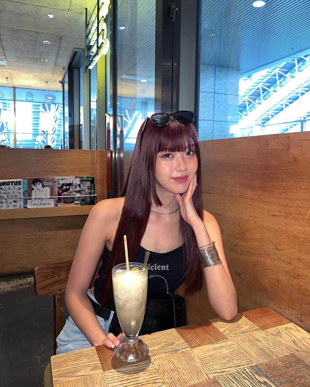 のインスタグラム：「⁡ ⁡ 東京中央美容外科新宿西口院 @tcb_shinjukunishiguchi で クマ取りをしてきて2週間経ちました🫧 ⁡ もう痛みもなく クマが薄くなってるのを感じます😌 完成が楽しみです🌿 ⁡ 担当は村田先生です！ @tcb_dsuke  ⁡ ⁡ #クマ取り #目の下のクマ取り #東京 #新宿 #クマ治療 #pr」