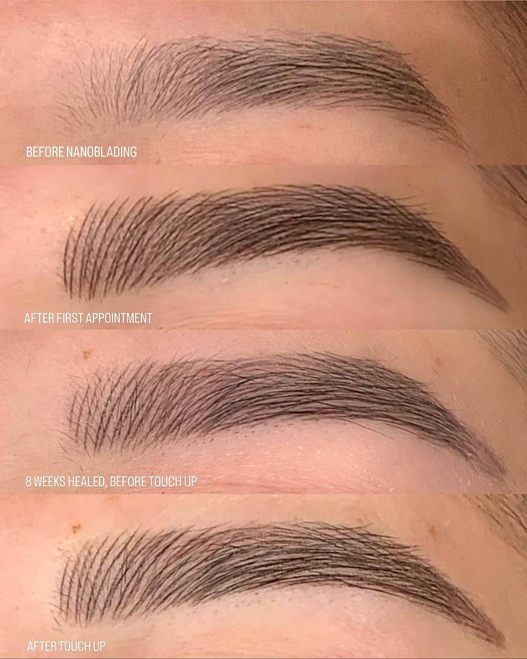 Haley Wightさんのインスタグラム写真 - (Haley WightInstagram)「A perfect example of the whole process ☝🏼  I always warn all of my clients during the first appointment that your brows will look a little bold, dark, and warm at first. They stay dark and warm for a few days and then start to softly lighten and neutralize. The healing process is super quick and easy, you’ll experience a little bit of flakiness for a day or two and that’s about it! Most of my clients actually don’t experience much or any flaking at all. Once you’re fully healed at around 6-8 weeks you’ll come back in for an easy touch up, I usually only have to go over a few strokes here and there that may have lightened during the healing process. We can also adjust color or shape if need be! After your touch up you should heal perfectly and have beautiful brows for 3-5 years 🥰  To book call (602)809-9405 or visit our website, link is in my bio!   #nanoblading #microblading #azmicroblading #azbrows #aznanoblading #aznanobrows #arizona #brows #scottsdale #phoenix」8月30日 1時51分 - cosmobyhaley