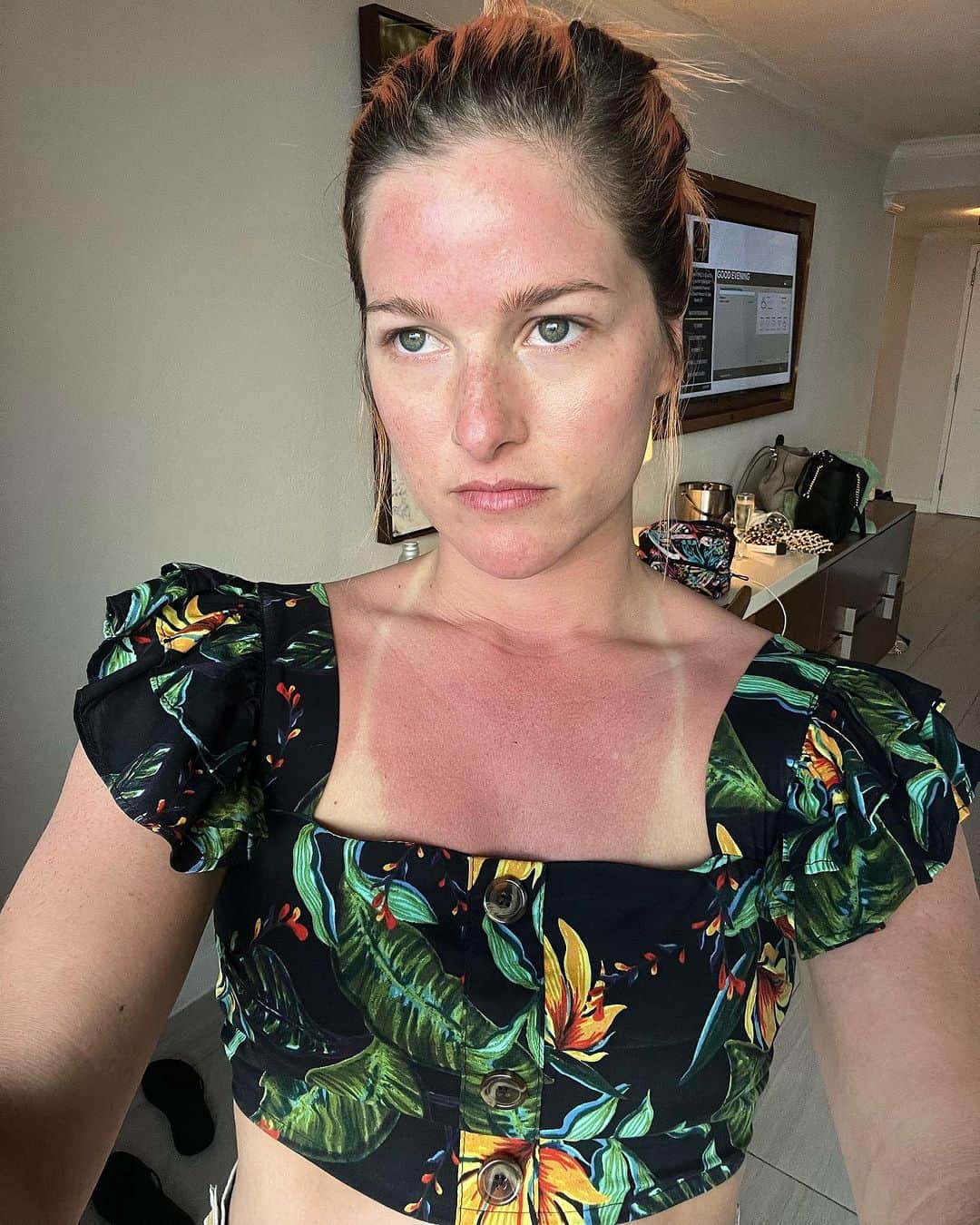 キャサディー・ポープのインスタグラム：「SPF 50 is a hoax.」