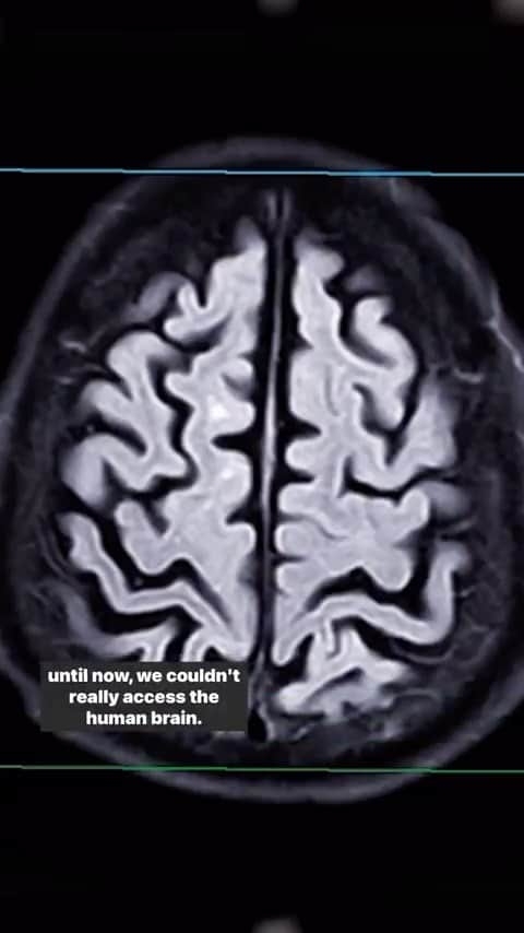 TED Talksのインスタグラム：「Fun fact: We can now grow parts of the human brain in a laboratory 🤯 Neuroscientist @SergiuPPasca and his team are using this new science to build tiny nervous systems that are helping demystify the brain and could lead to new medicines to cure diseases like Alzheimer’s. Visit the link in TED’s bio to watch the full talk. #coolscience #brain #mindblowing」