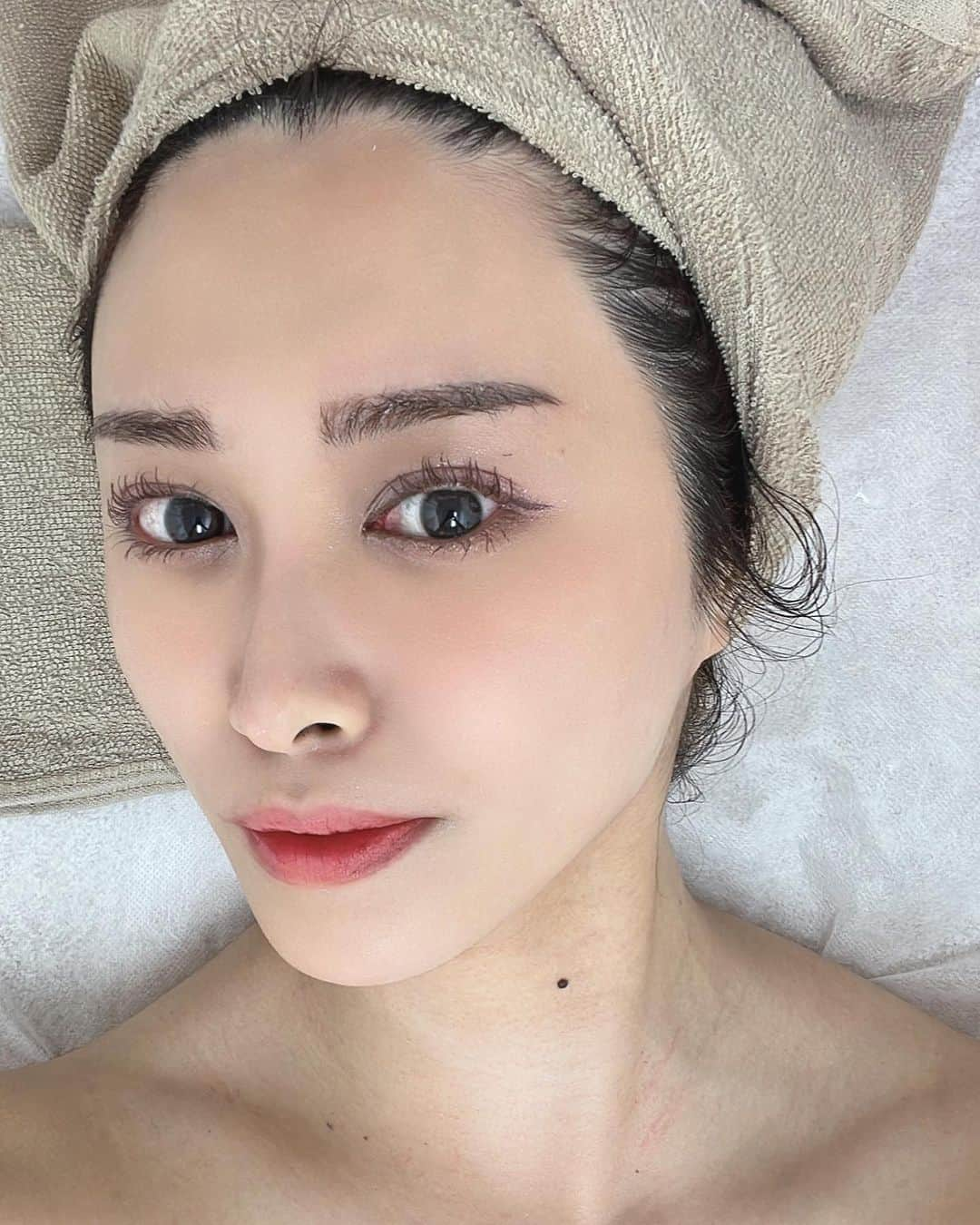 飛鳥凛さんのインスタグラム写真 - (飛鳥凛Instagram)「生まれて初めて、ずーっと気になっていた肌質改善へ行ってきました💆 ハーブ🌿や炭酸🫧乳酸菌🐮など自分に合ったメニューを選べるのでその日のコンディションでセレクト出来ました💕  炎症があって抑えたかったのと 乳酸菌←魅力的な単語に惹かれて今回は乳酸菌ピーリングを受けたよ♪ 受けながら説明を受けていたら最近調べていたクリスティーナ…ここで巡り会えるなんて😭  マイクロスコープで肌を見せてもらったら乾燥で砂漠化🏜️キメもなくツルツルの最悪のビニール肌💦 パック中の時も体全体をみてくださり沢山のアドバイス🥺✨ 全身でリラックス出来た後…  再びスコープでチェック📷 一度でたっぷり水分を入れ込んでもらえたのがハッキリ！キメが復活しました😭そして全体のトーンが上がりくすみが一掃🤍  駅から近くで綺麗なサロンで お姉さんも優しくリラックスして過ごせたよ💕  やっぱり自分で、自宅で出来る肌へのアプローチは限られてるからサロンに任せた方が良いなと思いました✨ 施術後1週間ほど経ったけどプルプルは継続中！今までのスキンケアもしっかり入り込んでる感覚がありメイクも時短に💄  サロン初めての方でもマンツーマンでつきっきり肌以外の色々な相談に乗ってくれるのでリラックスして施術してもらえるはず🥰  これからは肌質改善して綺麗に歳を重ねていきたいと思います💕  #アンリミット#エステサロン#血流からアプローチ#月1の楽しみ#美容day#水光肌#jetpeel #クリスティーナ#乳酸菌ピーリング#カーボキシー#肌質改善#ニキビ#デトックス」8月31日 9時05分 - rin_asuka0328