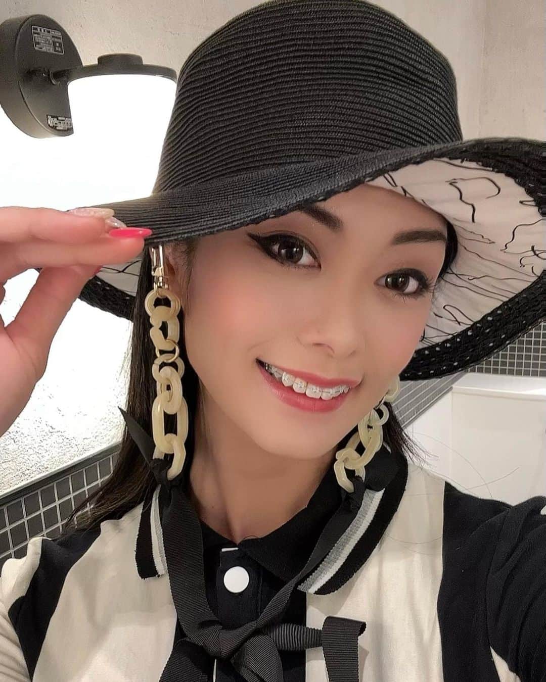 せいなさんのインスタグラム写真 - (せいなInstagram)「💕TCB 鼻尖形成 💕 . . 今日は、群馬県高崎市にある東京中央美容外科TCB高崎院( @tcb_takasaki )に行って来ました〜✨ . . 前から、少し悩んでいた"だんご鼻👃"と左右の鼻の穴の大きさが違うことを院長の百瀬先生　(@tcb_momose )に相談させて頂きました☺️💖✨ 私は、小さい頃から鼻の骨が曲がっているので、 軟骨の大きさも左右違かったりで、難しいようでしたが、 丁寧に分かりやすく説明して下さって、私に合った方法を一緒に選んで貰いました✨ . . 不自然な鼻にはなりたく無いので、凄く悩んでいましたが、 今回は高さを出さず自然に鼻を小さく、シュッとした印象になるように鼻尖形成という施術をして貰ったよ✨ . . 初めてなので、ドキドキしましたがスタッフさんやドクターの百瀬先生が丁寧に説明しながら、施術をしてくれたお陰で安心して受けられました☺️💖 . . 施術は、麻酔注射が少し痛いくらいで、後は痛みも無く無事に終わりました💫 終わった後に、鏡で確認したら、今まで無かった鼻先が出来ていて、綺麗な鼻の形に感動〜🥺💖✨ . . 鼻って顔の中心だから、1番大事な部分だと思うから、 早くやれば良かったなぁ〜って思いましたww😂💖✨ . . 悩んだ末に、施術して貰って本当に良かったです☺️‼️ ありがとうございました💖✨ . . 術後のダウンタイムが少しあるので、少し腫れてますが、 落ちついたらBefore⇆Afterも載せていきますね✨ . . #TCB #tcb鼻尖形成 #小鼻 #鼻先 #鼻整形 #高崎 #群馬 #美容 #美容整形 #美 #モデル #PR #インフルエンサー #東京中央美容外科 #beauty #model #instagramers #dancer」8月31日 13時16分 - seina_k0403