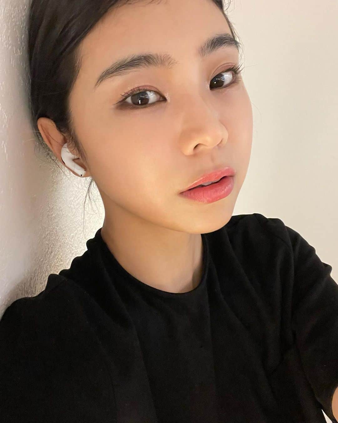のインスタグラム：「遂に長年のコンプレックスだったクマとさよならしました🥲🫶 目の下脂肪再配置はめちゃくちゃ腫れたけど痛みが全くなくて良かった！ ダウンタイムをYouTubeで14日分全部公開したからチェックしてね💗  今回お願いしたのは今年の6月にオープンしたばかりのETONNEさん🏥 ソウル大出身の整形外科医の院長先生、麻酔専門医常駐、専門資格を持った日本人スタッフさん常駐の病院で、アフターケアまでしっかりサポートしてくれて初めての手術だけど安心して２週間過ごせました🫶 お問い合わせは公式LINEからできるので是非🥰  #ETONNE」