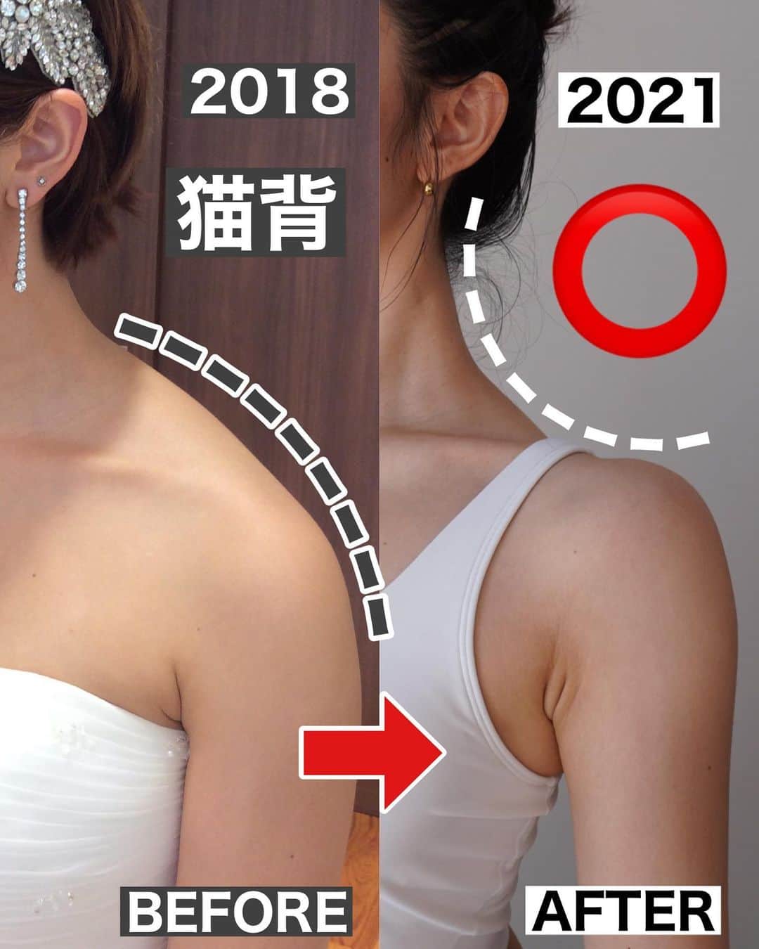 佐川裕香のインスタグラム：「\月額オンラインレッスンお申込み受付け開始/   『ぽっこり首まわり・つらい肩こり』  頭の重さは約5kg 500mlのペットボトル約10本分！！が頭！！  この頭の位置が重心線より前に出てしまうと 重たい頭を支えなければ！と 必要以上に筋肉が働き からだ全体の負担が増え、首・肩こりや腰痛  そしてぽっこり首、フェイスラインのもたつき 、大きく丸い背中などボディラインの崩れにも繋がります。  マッサージなどで首の筋肉を緩めても一時的に楽になってもすぐにまた元通り 重心から変えていきましょう！  『足』は画像のような、首・肩にも関係します  今回お申込みで『足』の特別レッスンアーカイブをご視聴いただけます！  この機会に是非ご参加ください！  --------------------------------------------  根本からからだを変えていきたい方の為の オンラインレッスン✔︎  ▶︎募集期間 →9/6(日)23:59まで‼️  ✳︎年内、第一週目は \2023年！駆け込みボディメイクプログラム/ と題し、ボディメイクにおいて必ずここは押さえたい部分を効果的、かつ集中的に行います。  この機会にぜひご参加下さい✳︎  ✔︎お申込みいただいたその日から 過去２ヶ月分のレッスンアーカイブを視聴可能 ✔︎9割以上の方がアーカイブのみでご参加下さっています  プロフィールのURL、MOSHサイトから お申込み受付けさせて頂きます✨  --------------------------------------------  We are accepting applications for monthly online lessons! For more information, please visit the instgram URL✨  https://mosh.jp/services/107752  Languages are here ●Subtitle languages↓ *May be English only in some areas  English/한국어/繁體中文/‎العربية/Italiano Bahasa Indonesia/Svenska/Español/ไทย/Deutsch/Türkçe Français/Tiếng Việ/ Português/Русский  --------------------------------------------」