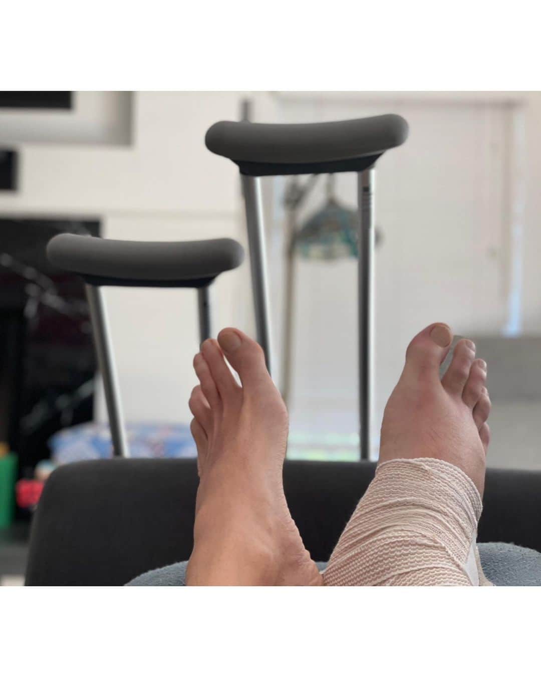 ジョン・ロス・ボウイのインスタグラム：「Summer photo dump- my first broken bones, but a lot of joy nonetheless. #limptowardsyourbliss UPDATE: foot is much better, the scary photo is from June」