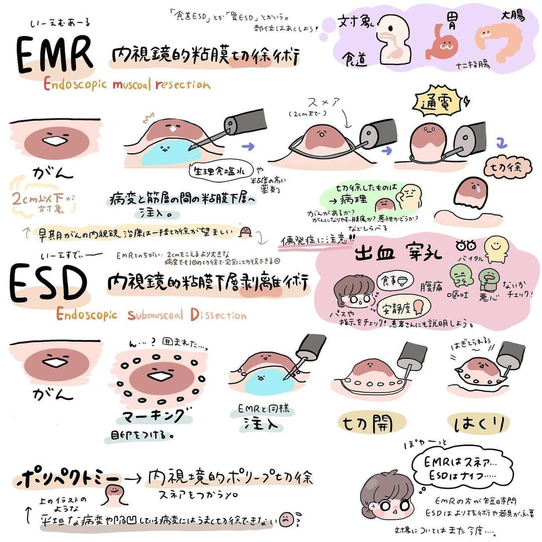 はやさんのインスタグラム写真 - (はやInstagram)「いつもどっちがどっちか ややこしくなってたEMRとESD😇  #看護師#看護師あるある#看護師勉強垢#看護師ママ#看護学生#看護学生勉強垢#看護師国家試験#イラスト#看護師イラストレーター#procreate#プロクリエイト#内視鏡#内視鏡看護師」9月3日 19時37分 - hayao_kam