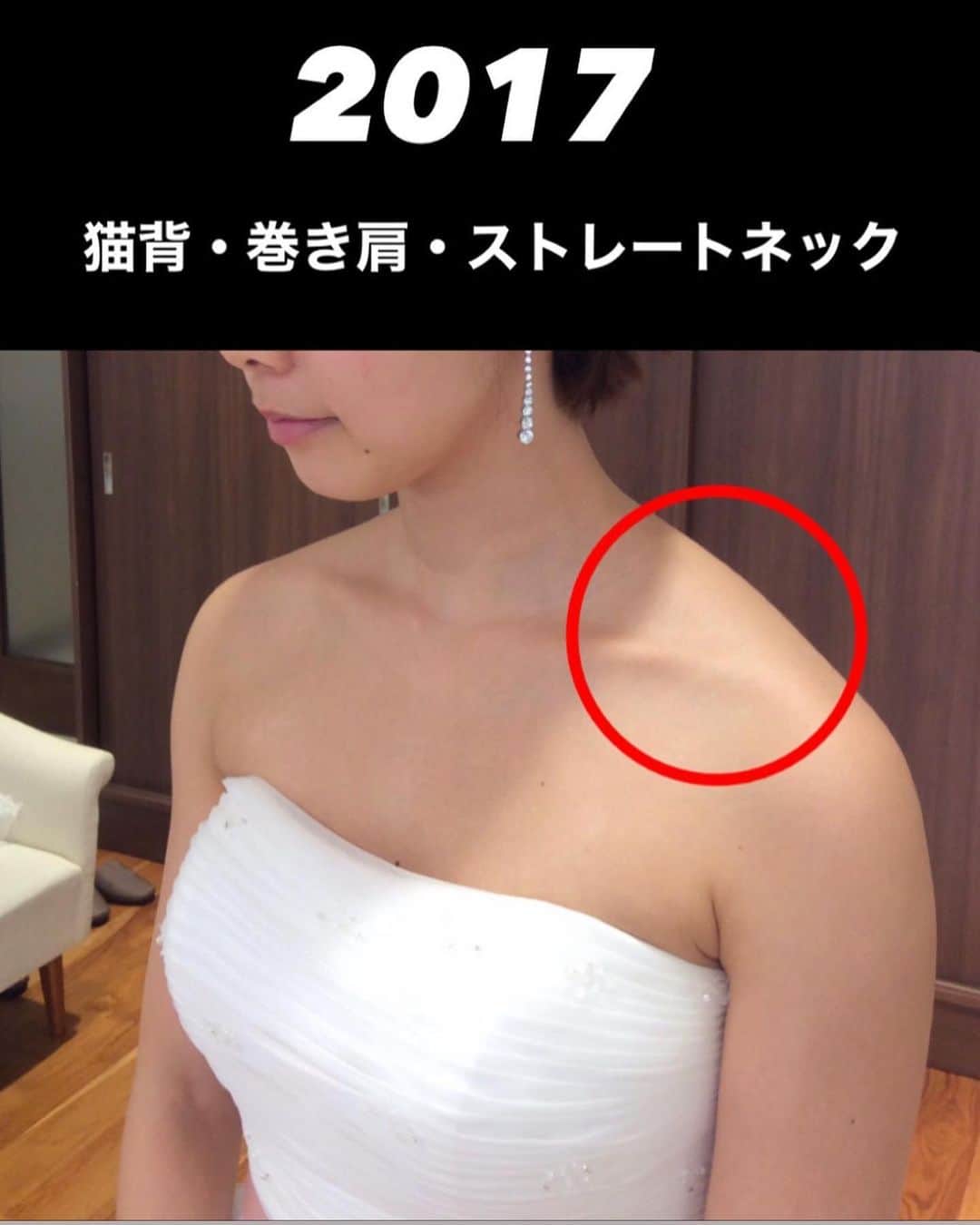 佐川裕香さんのインスタグラム写真 - (佐川裕香Instagram)「【月額オンラインレッスン募集・残り３日】  突然ですが... 『鎖骨』を意識したことはありますか？  大前提、『全身』繋がっているので 『ここだけ』が大事と言うことではありません。  ただよく肩甲骨はがし、肩甲骨ストレッチなど肩甲骨については耳にすることがある方も多いと思います（肩甲骨はがしと言うワードもありますがそもそも肩甲骨は浮いてます）  ですが鎖骨というのはトレーニングを日頃している方でも中々、意識しない部分なのではないでしょうか？  肩甲骨に意識を向けて 肩が上がってしまったり、背中のトレーニングをしてるのに逆に首や肩が凝ってしまう方！  何をしてもガチガチな 首、肩、背中まわりがスッキリ 腕も上がりやすく、スラッとする使い方を  月額オンラインレッスン 9月13日の上半身クラス『鎖骨、リセット。』 で少し視点を変え、その方法をお伝えしています。  ✔︎鎖骨が動く⇄肩甲骨が動く  アーカイブの視聴期限は『レッスン日より2ヶ月間』今回、お申込みでこちらのアーカイブもご視聴間に合います。  いつもとは少し違う視点から、アプローチすることで、 からだの動かし方の変化につながる。  そこから得た小さな気づきがやがて大きな収穫へ  そして着実にボディライン、からだの体感に反映される..  積み重ねは、数ヶ月後に大きな差となります 　　　↓ 　　　↓ 　　　↓  期間限定！月額オンラインレッスンお申込み受付け ▶︎10月7日(土)23:59まで！  プロフィールのURL、MOSHサイトから お申込み受付けさせて頂きます  --------------------------------------------  ✔︎お申込みいただいたその日から 過去２ヶ月分のレッスンアーカイブを視聴可能 ✔︎9割以上の方がアーカイブのみでご参加下さっています  --------------------------------------------  We are accepting applications for monthly online lessons! For more information, please visit the instgram URL✨  https://mosh.jp/services/107752  Languages are here ●Subtitle languages↓ *May be English only in some areas  English/한국어/繁體中文/‎العربية/Italiano Bahasa Indonesia/Svenska/Español/ไทย/Deutsch/Türkçe Français/Tiếng Việ/ Português/Русский  --------------------------------------------」10月4日 18時46分 - yuuka_08